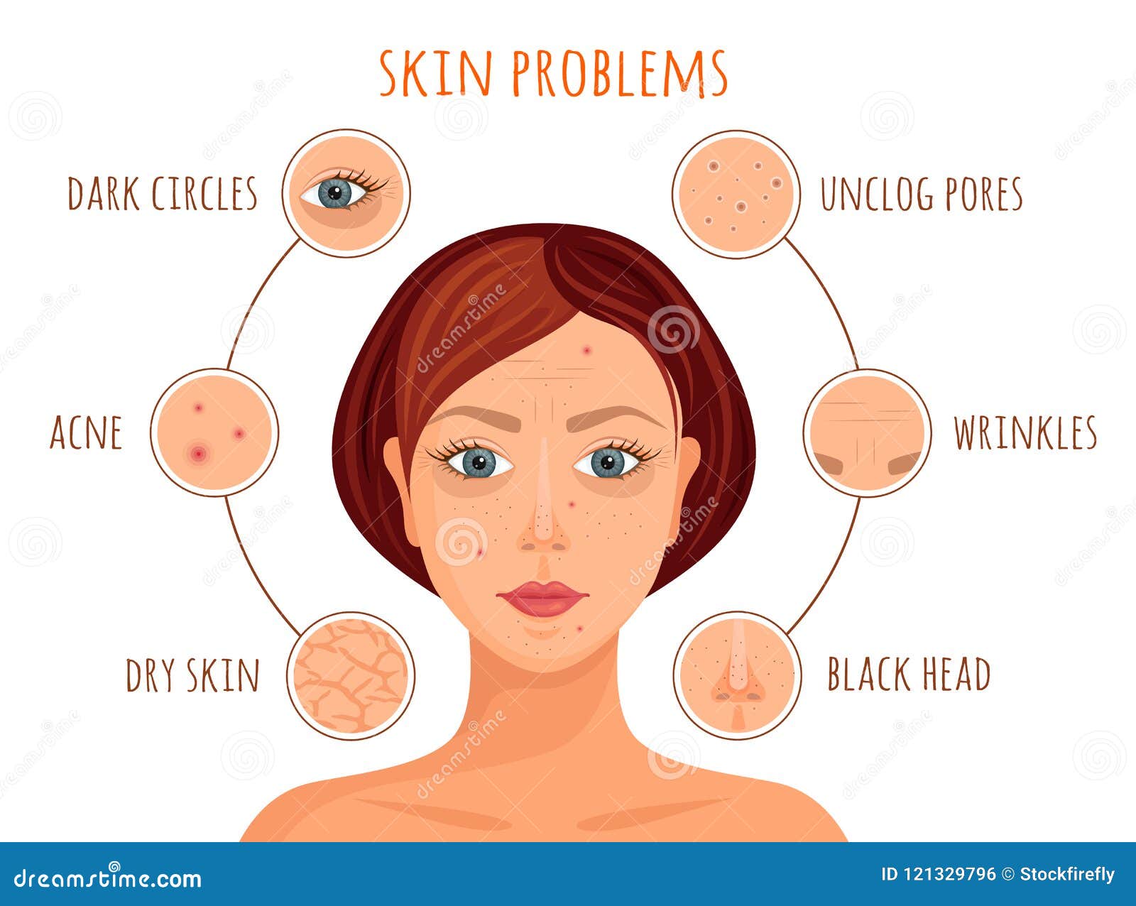 Skin Problems Infographics Vector Stock Vector Illustration Of