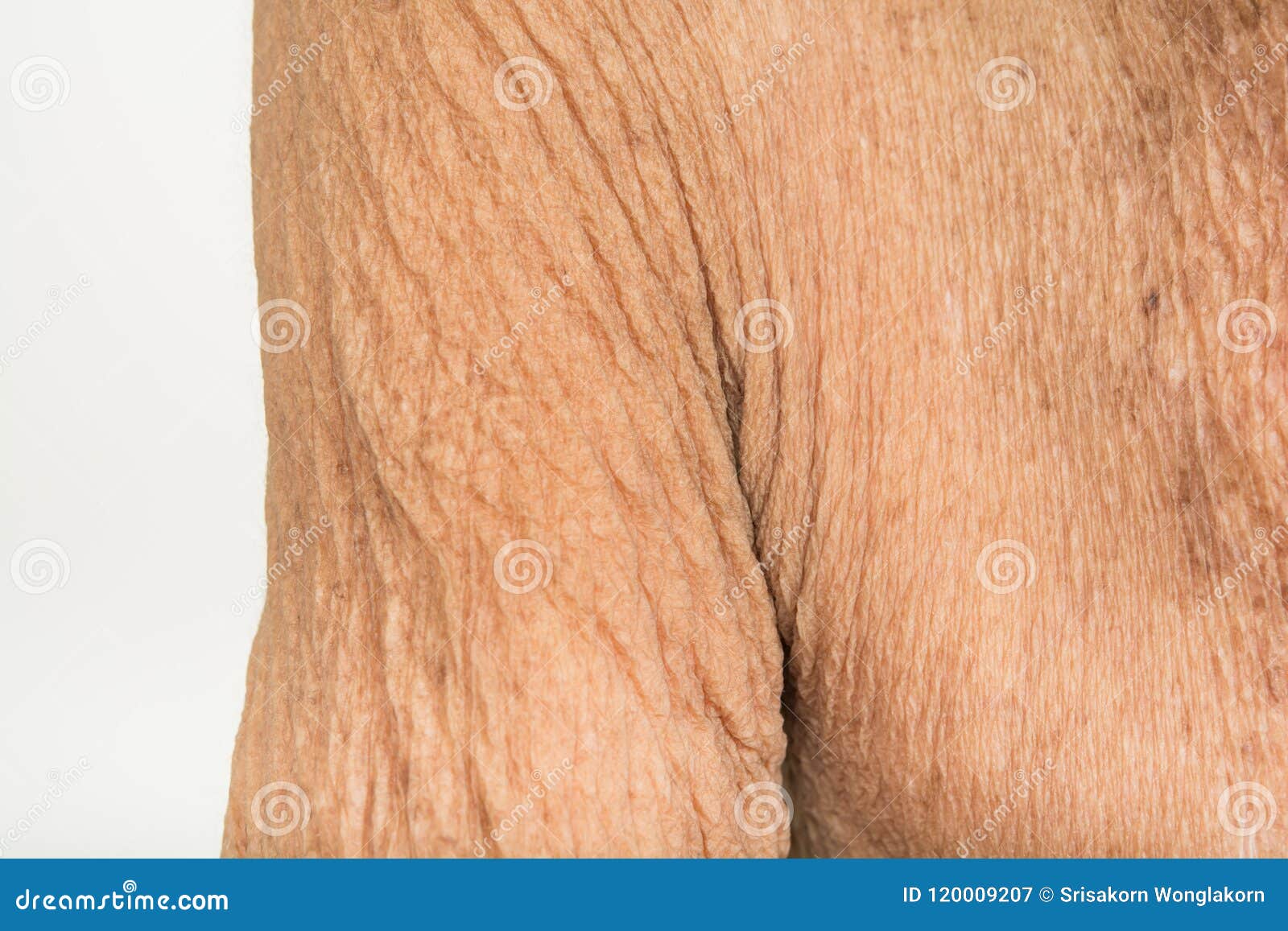 skin and wrinkle treatment wrinkles