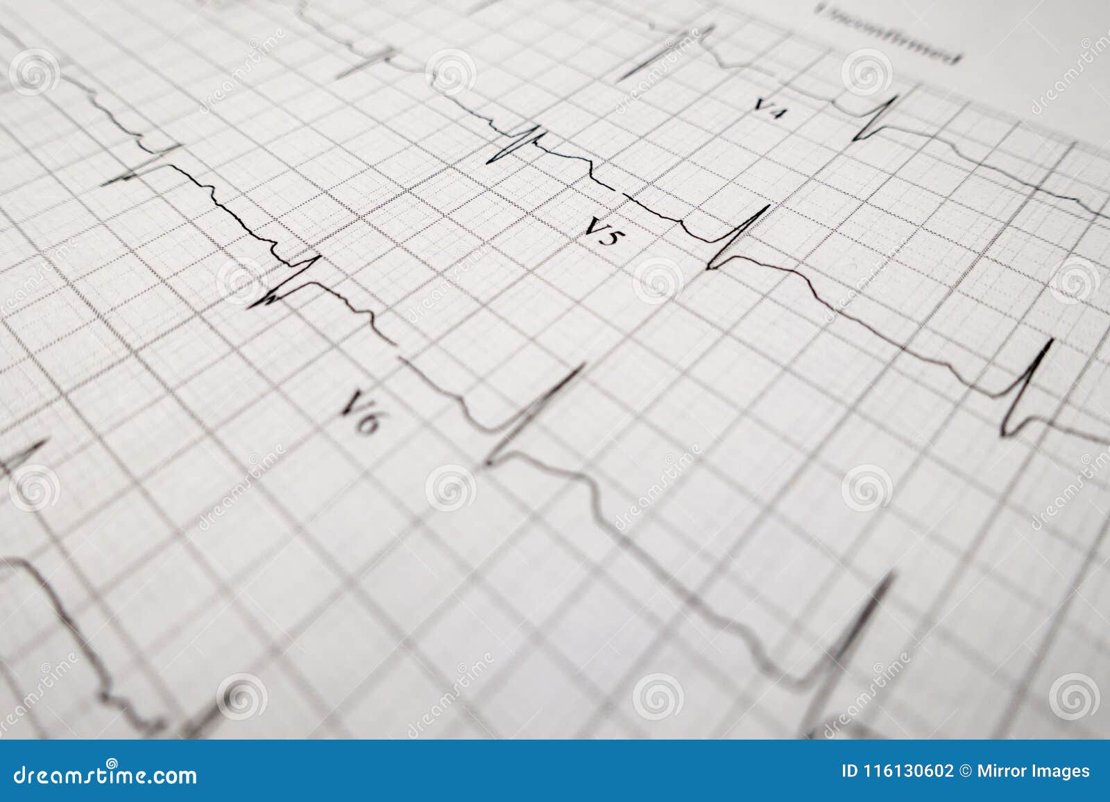 Focus Test Chart Download