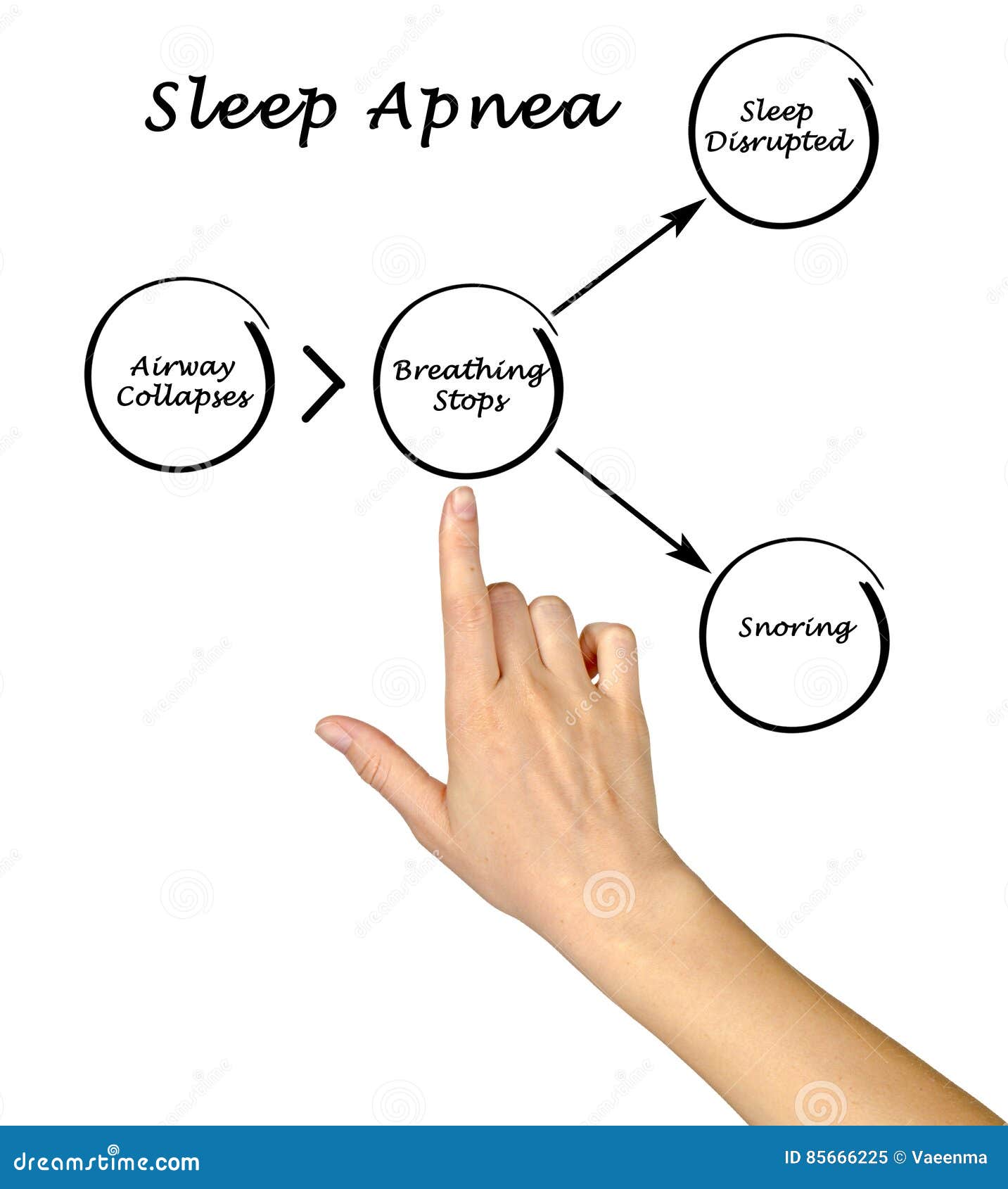 [DIAGRAM] Normal Sleep Diagram - MYDIAGRAM.ONLINE