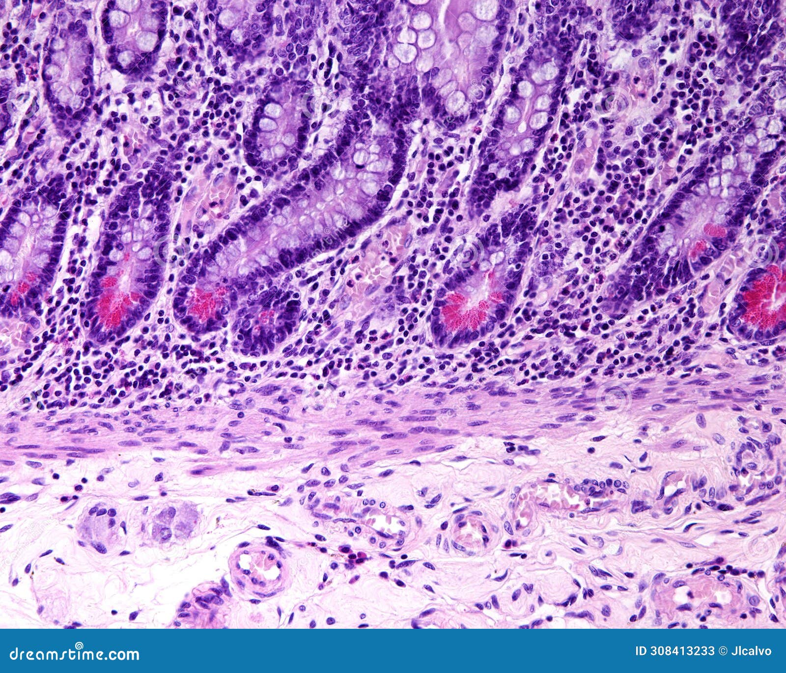 small intestine. paneth cells