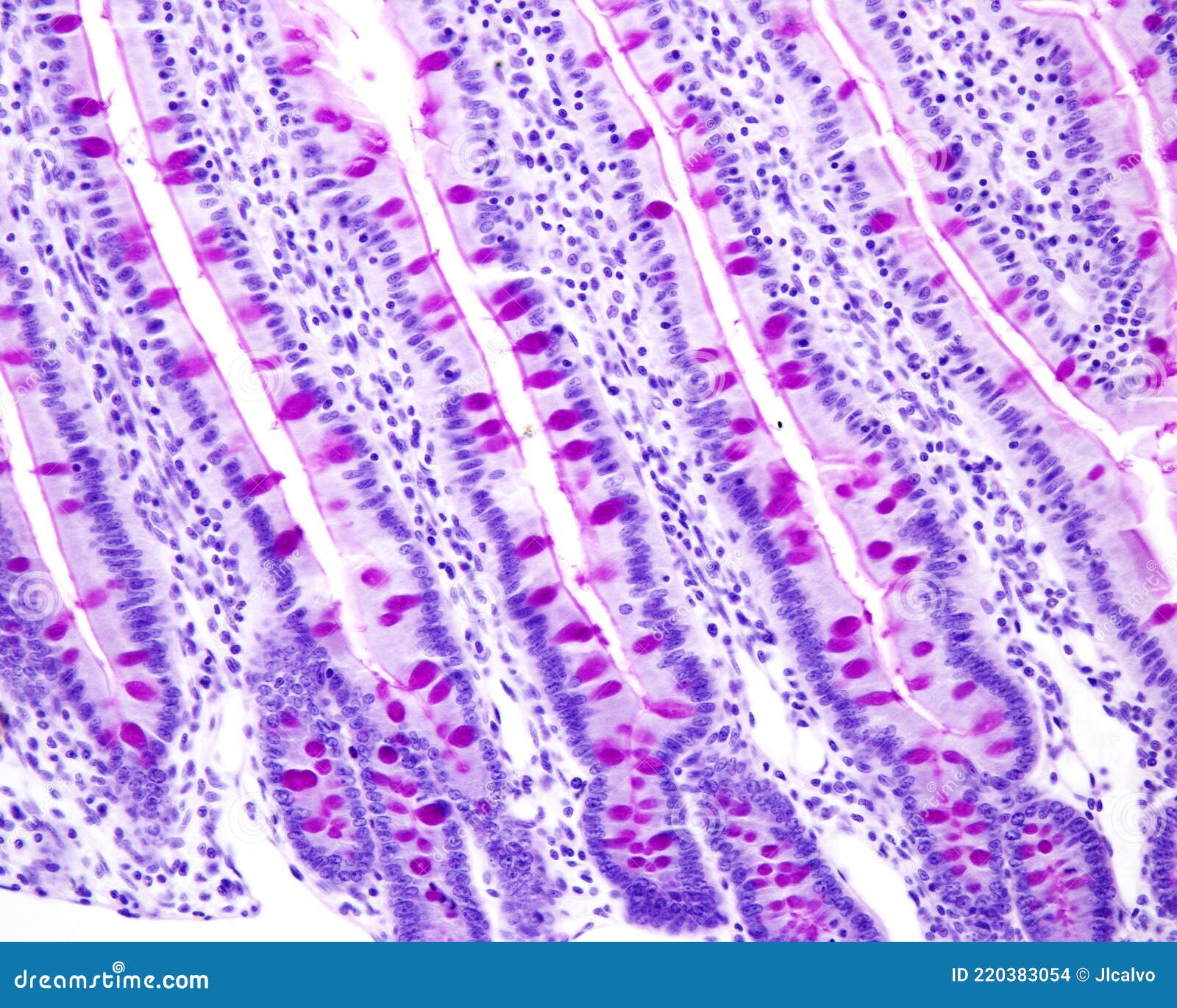 Small Intestine Duodenum And Vermiform Appendix Human Under The ...