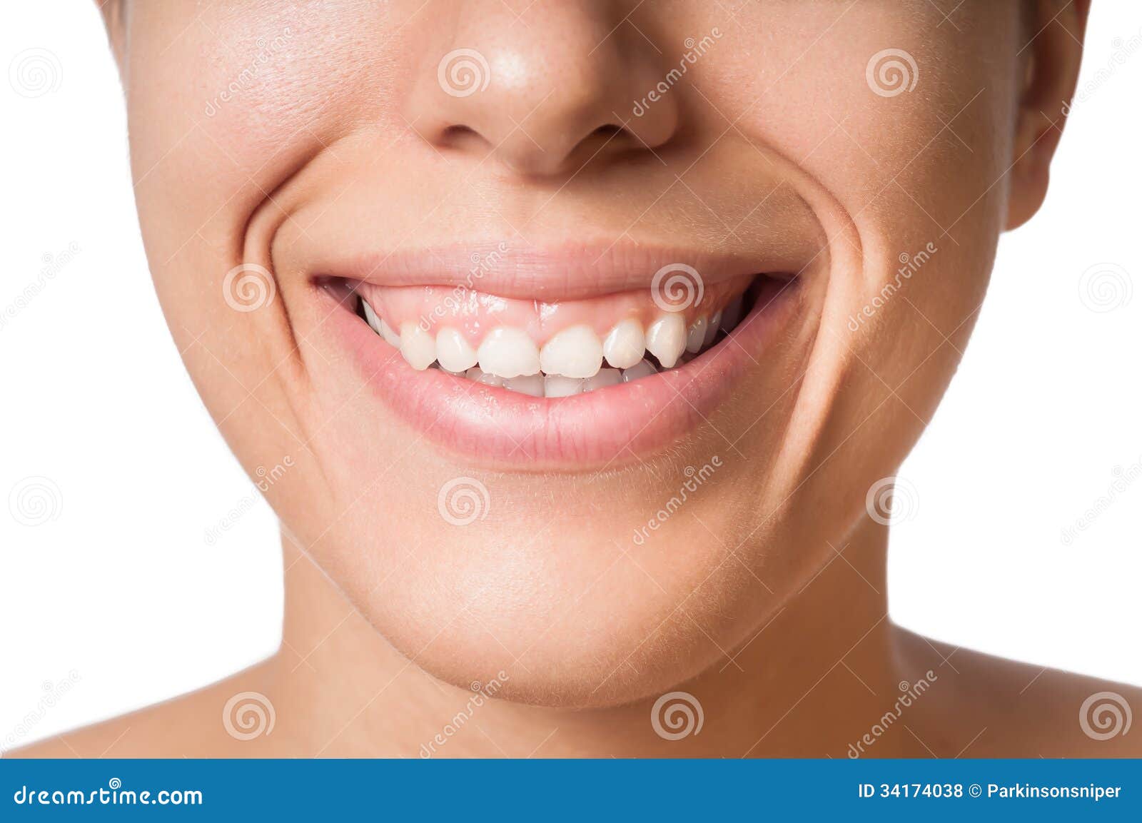 small teeth