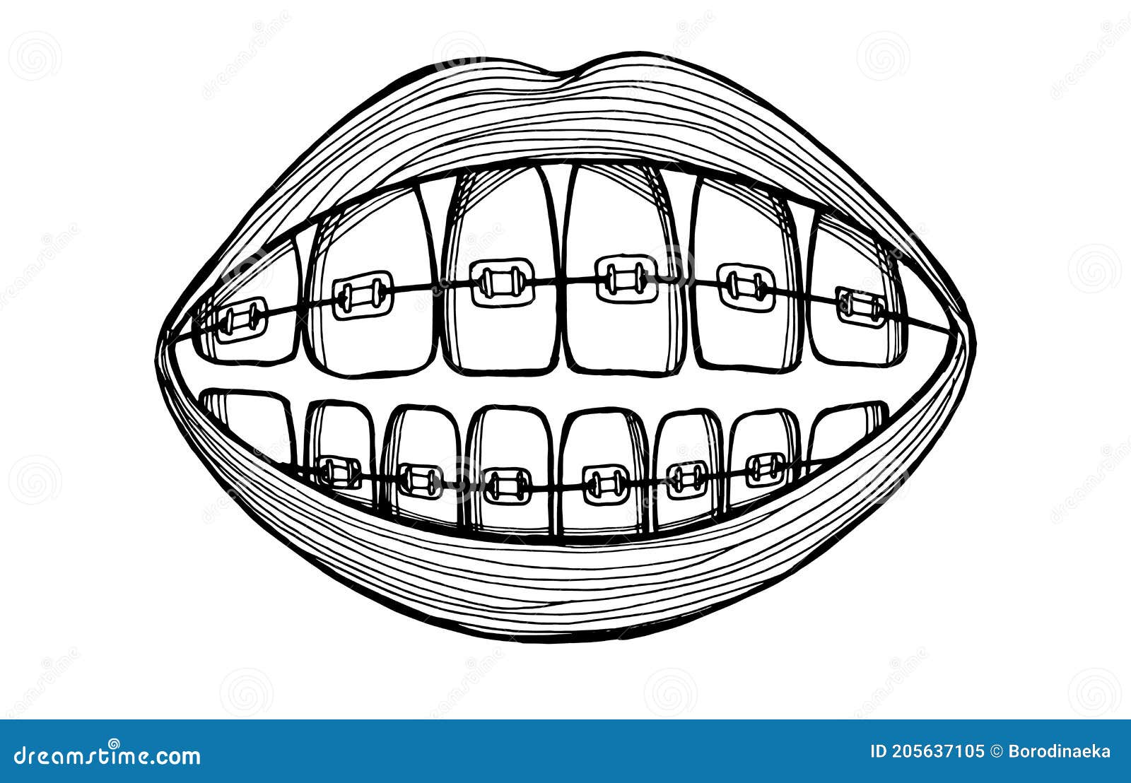 Smile with braces. stock vector. Illustration of background 205637105