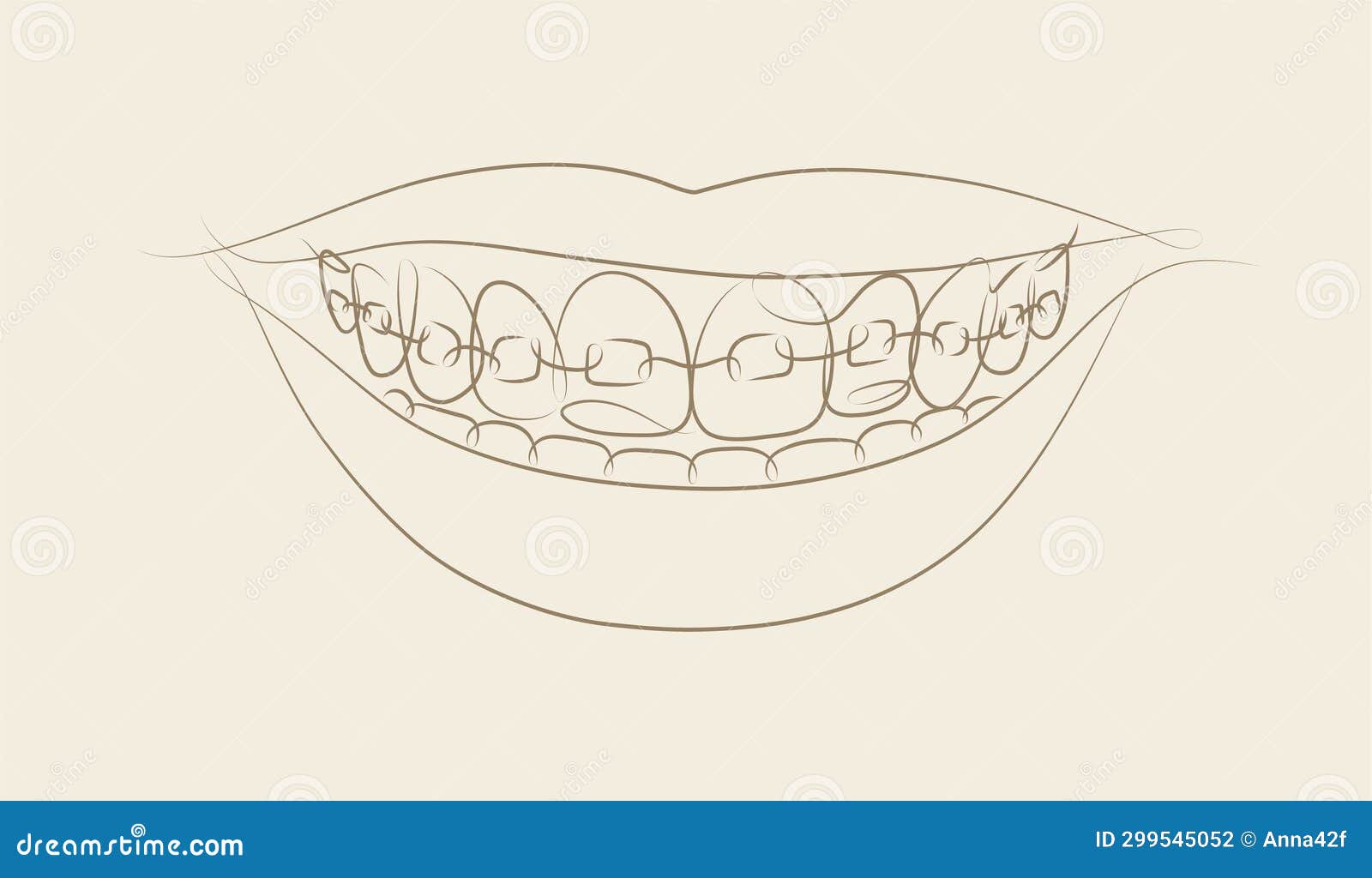 Smile with Teeth Braces Beige Color Stock Vector Illustration of