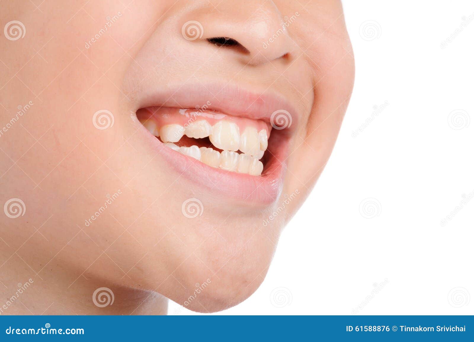 smile teeth kids