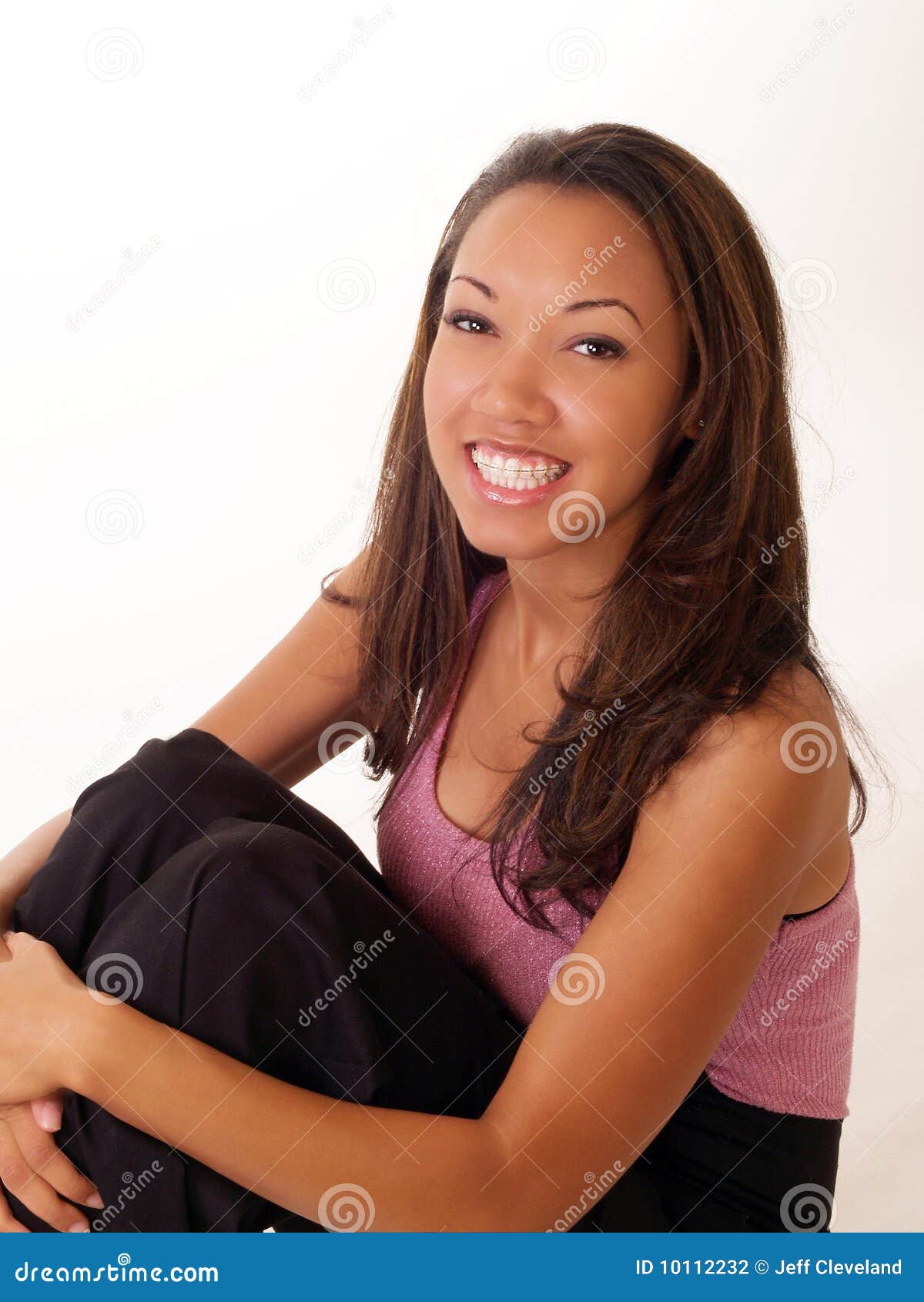 Smiling Black Woman With Braces On Upper Teeth Sto