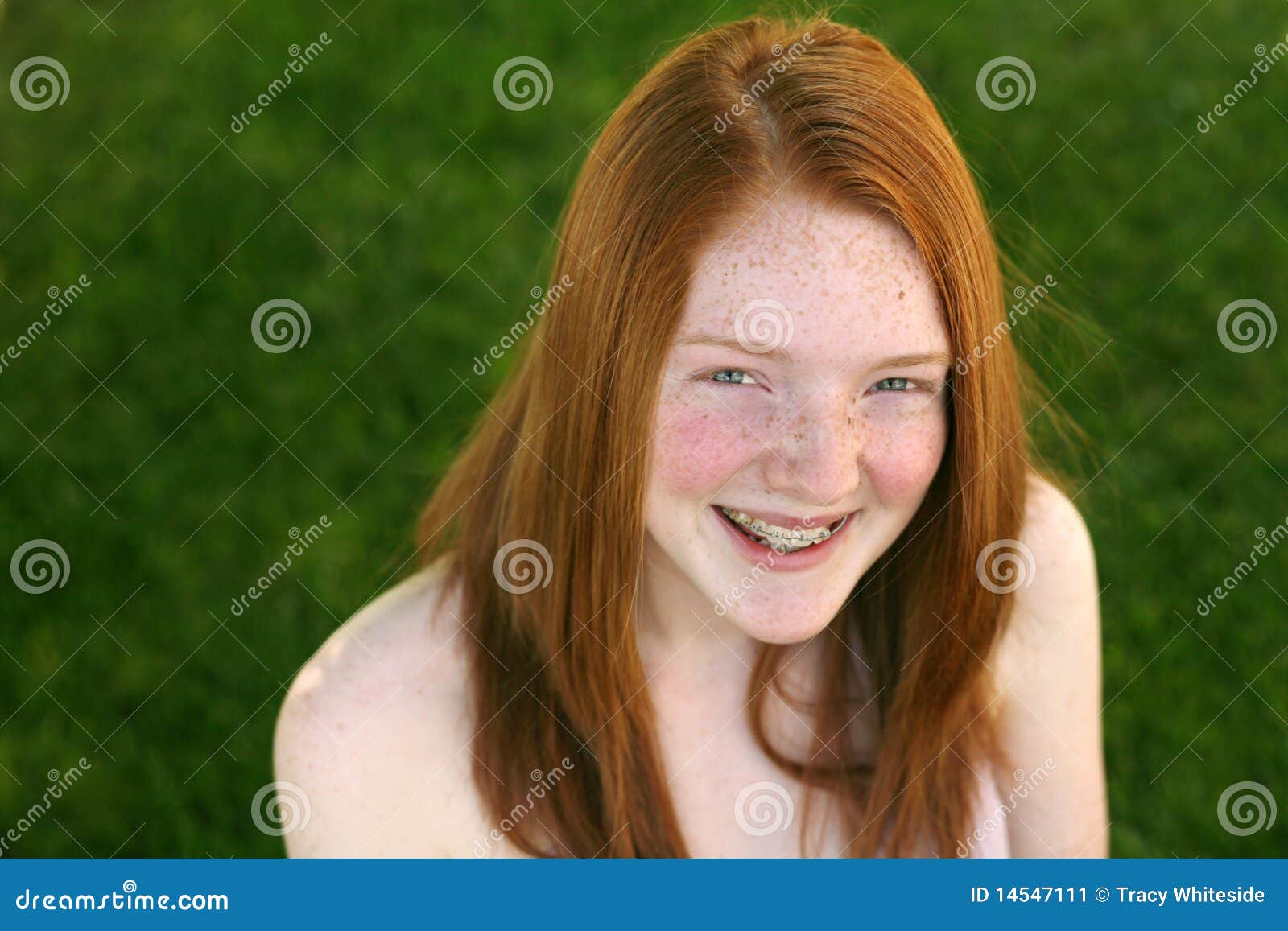 redhead girls with braces pic from sex video
