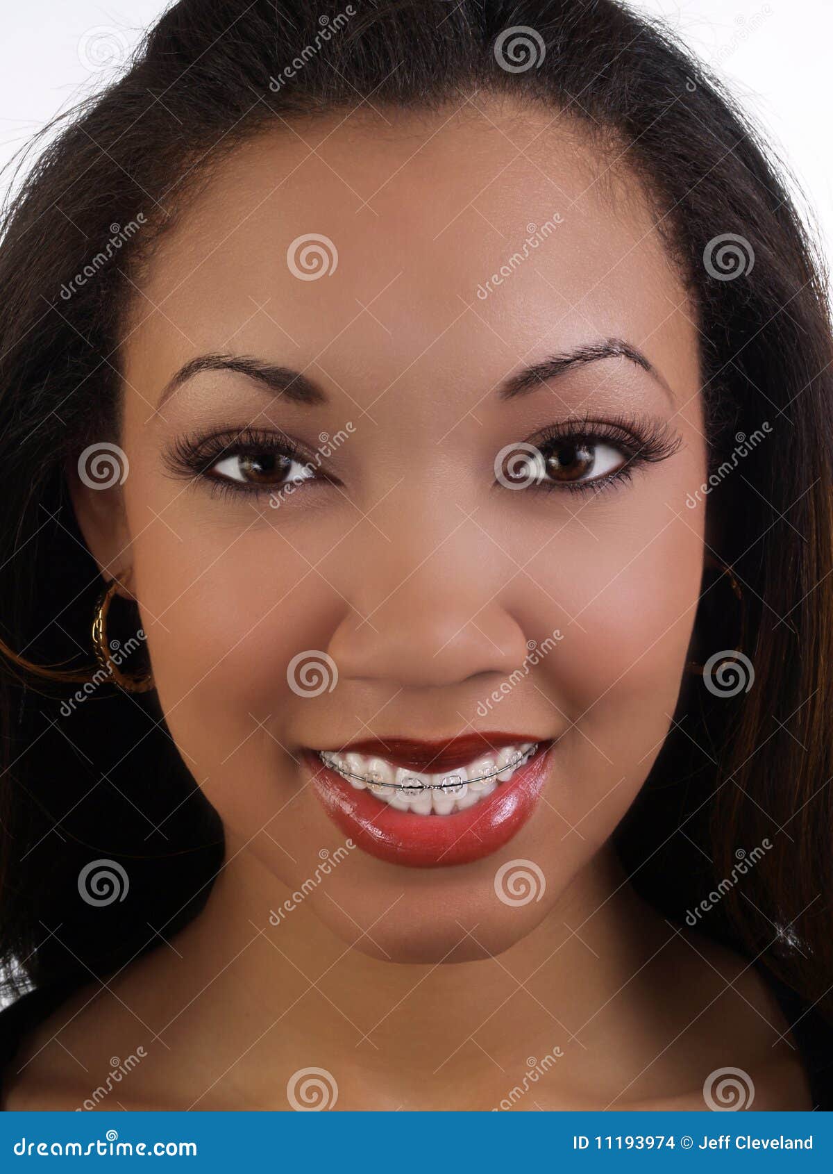 Smiling Young Black Woman with Braces Upper Teeth Stock Photo Image