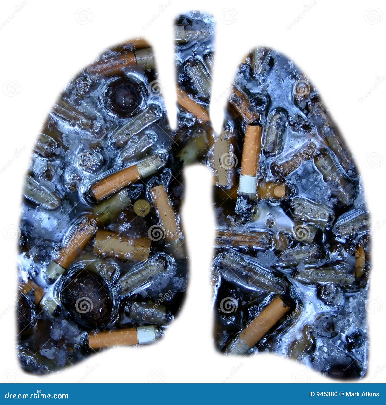 Smokers lungs stock photo. Image of effects, stop, anatomy - 945380