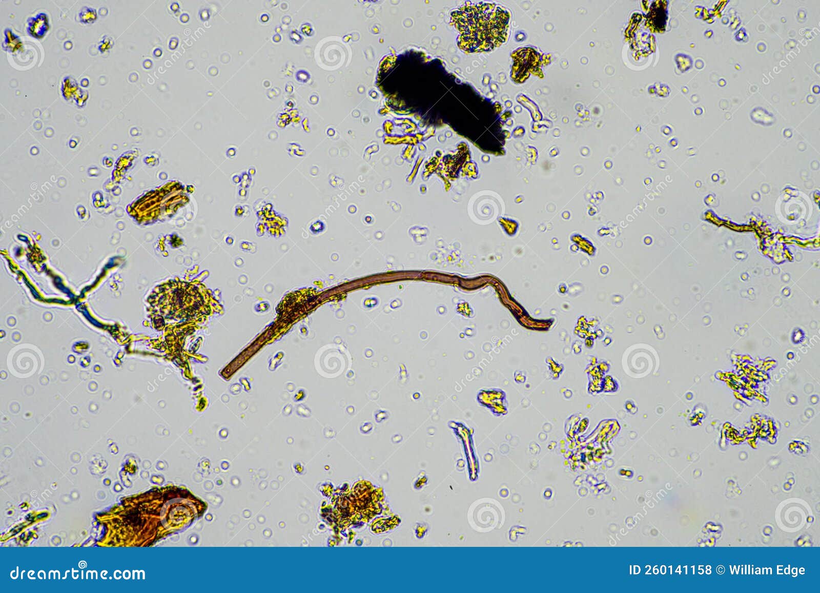 microorganisms in pond water under microscope