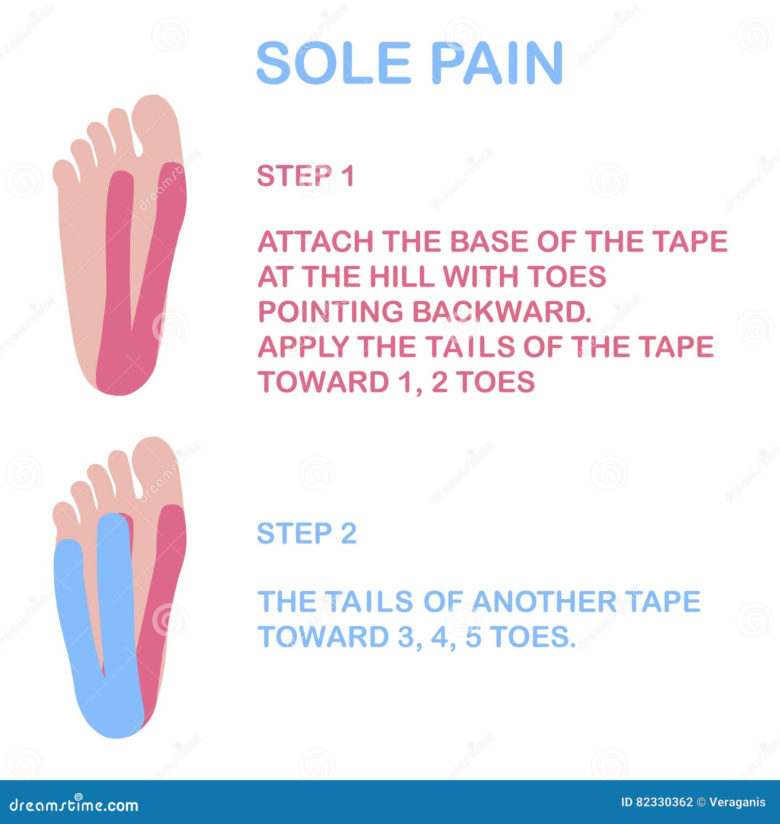 Sole Pain. Correct Kinesiology Taping Stock Vector Illustration of