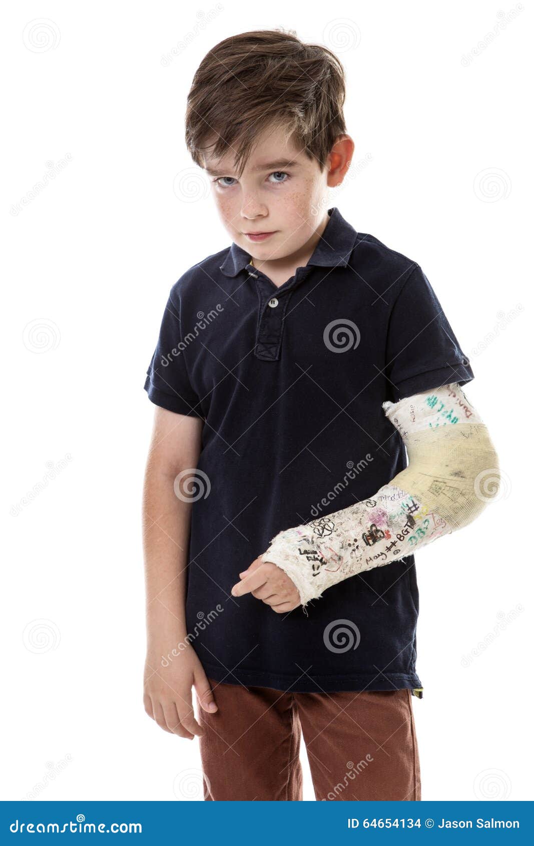 Sore broken arm stock photo. Image of isolated, male 64654134