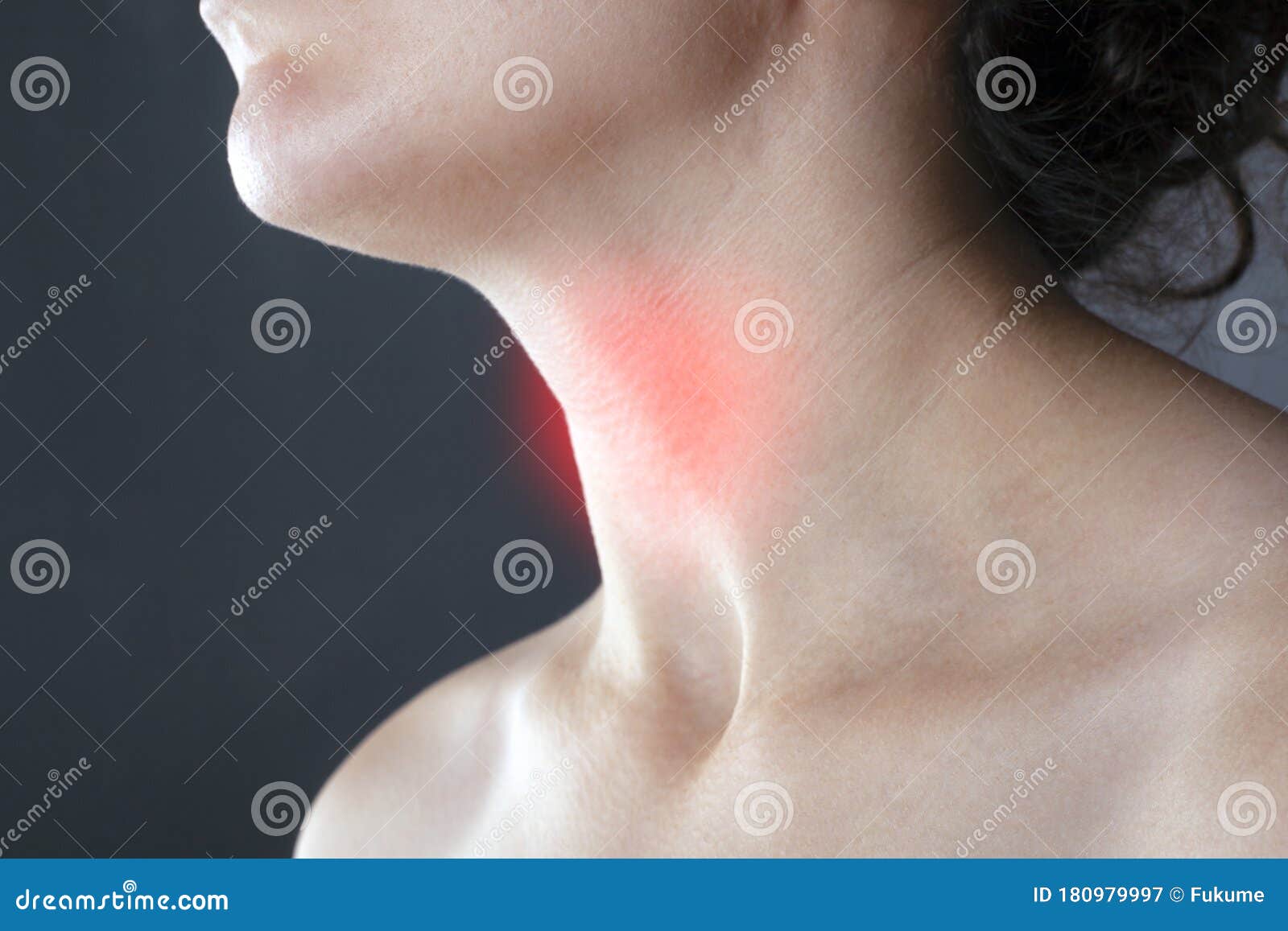 Sore Throat Allergy Flu Cold Angina Inflamed Lymph Nodes Stock Image