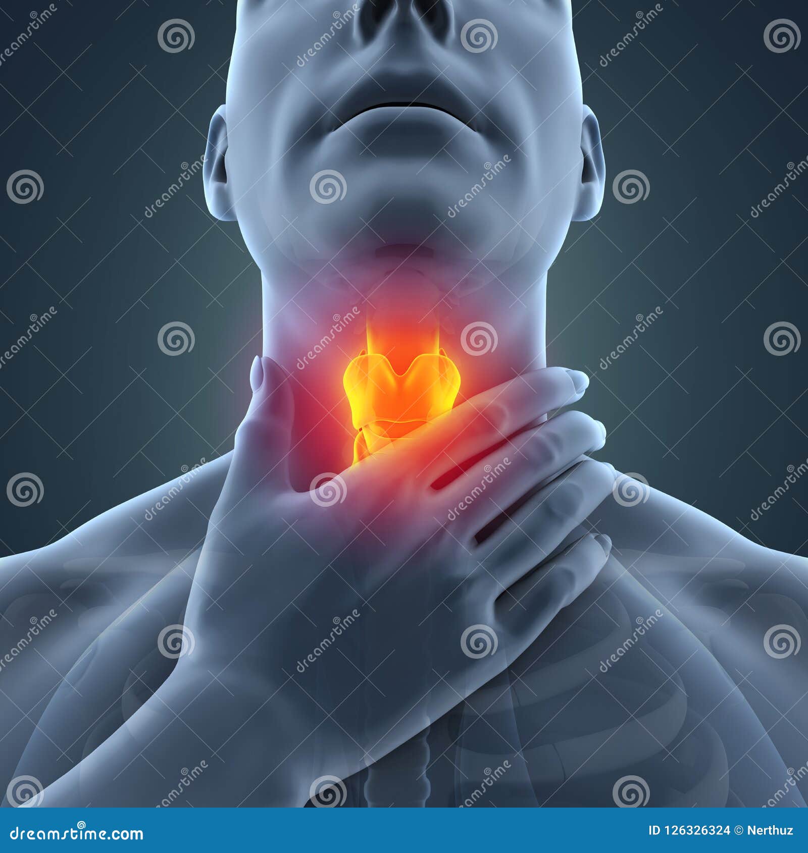 Sore Throat Illustration Stock Photography 126326324
