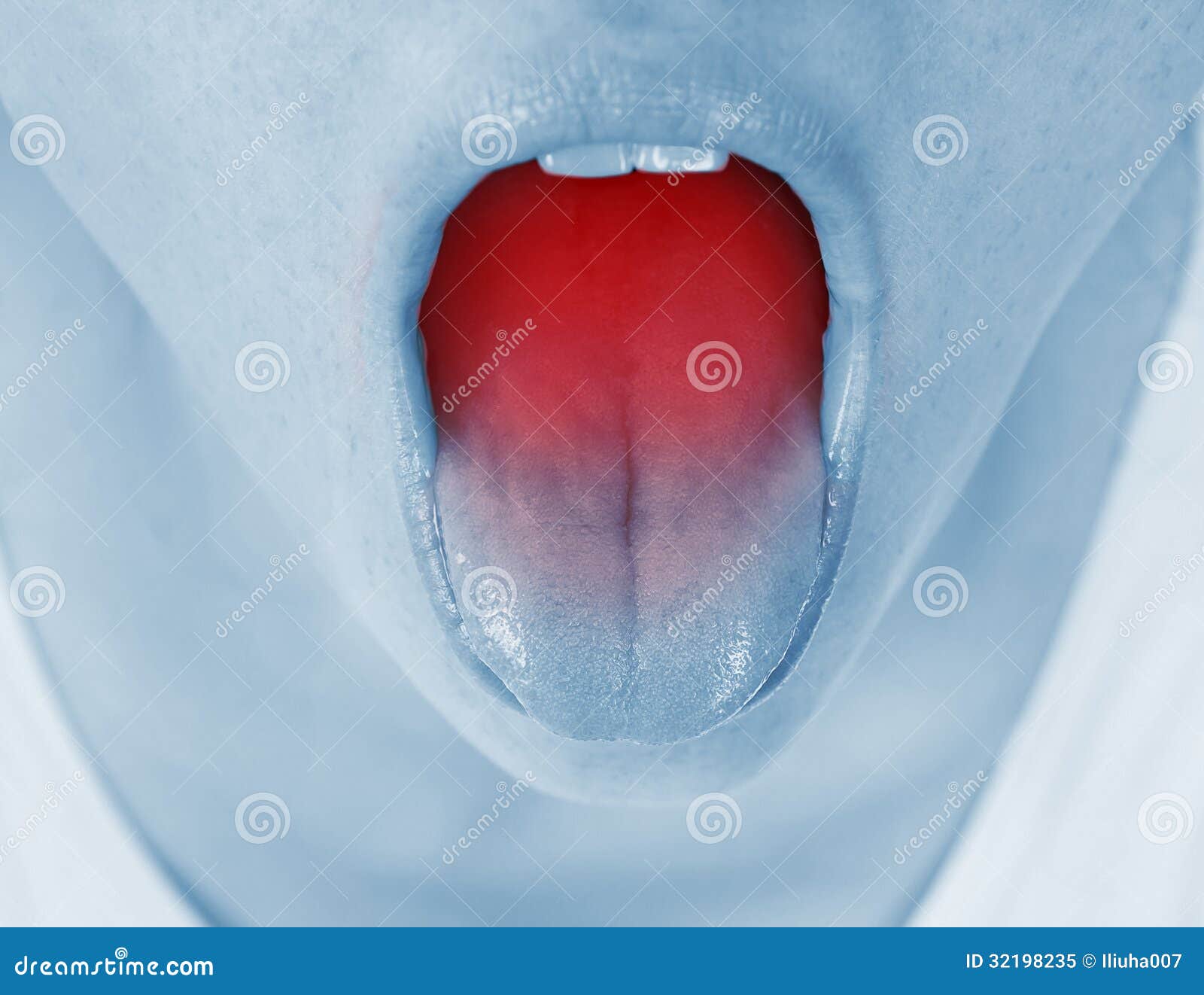 Sore throat, shown red stock image. Image of pain, heartburn 32198235