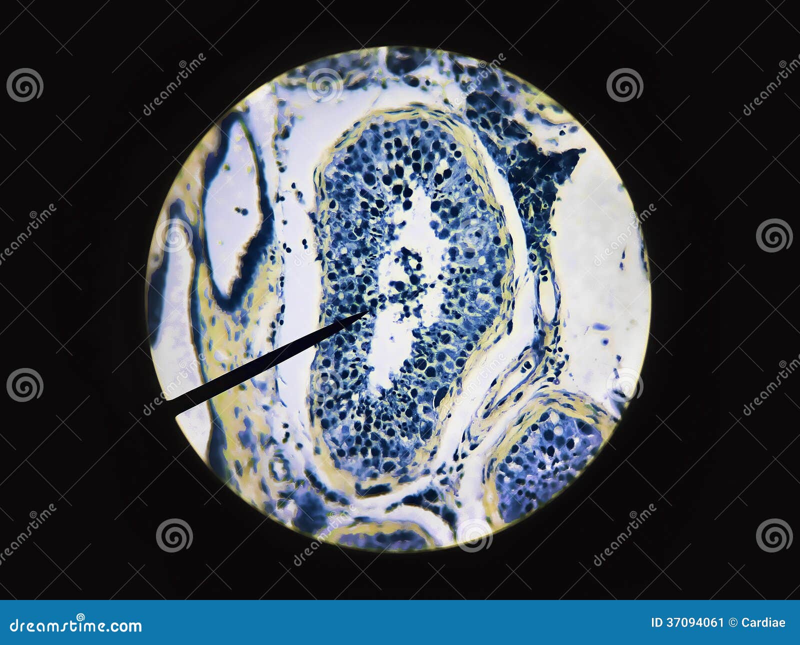 sperm produced in the male testes testis anatomy physiology