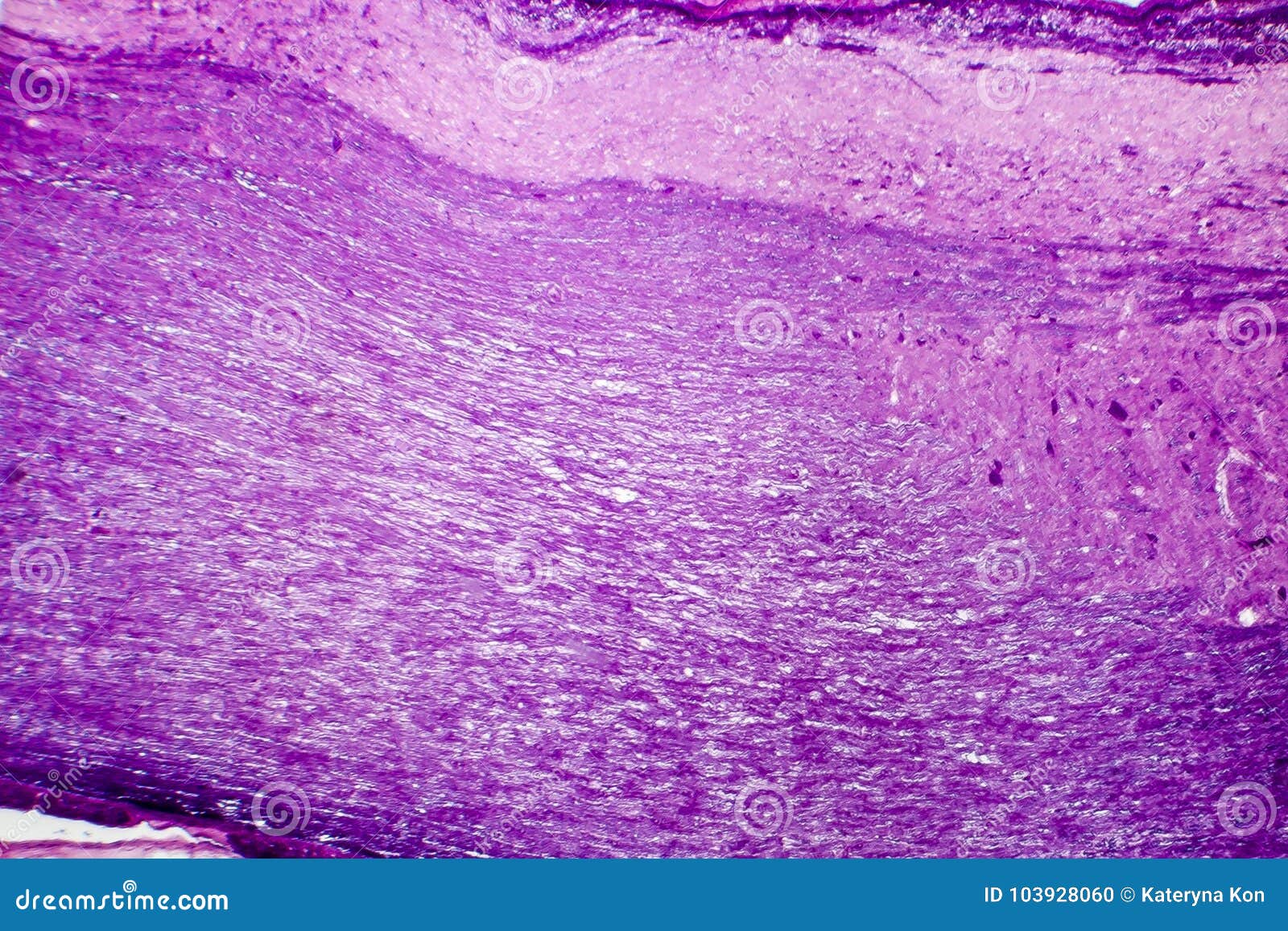 Spinal cord, cross-section stock photo. Image of microphotograph - 103928060, image size:1600x1157