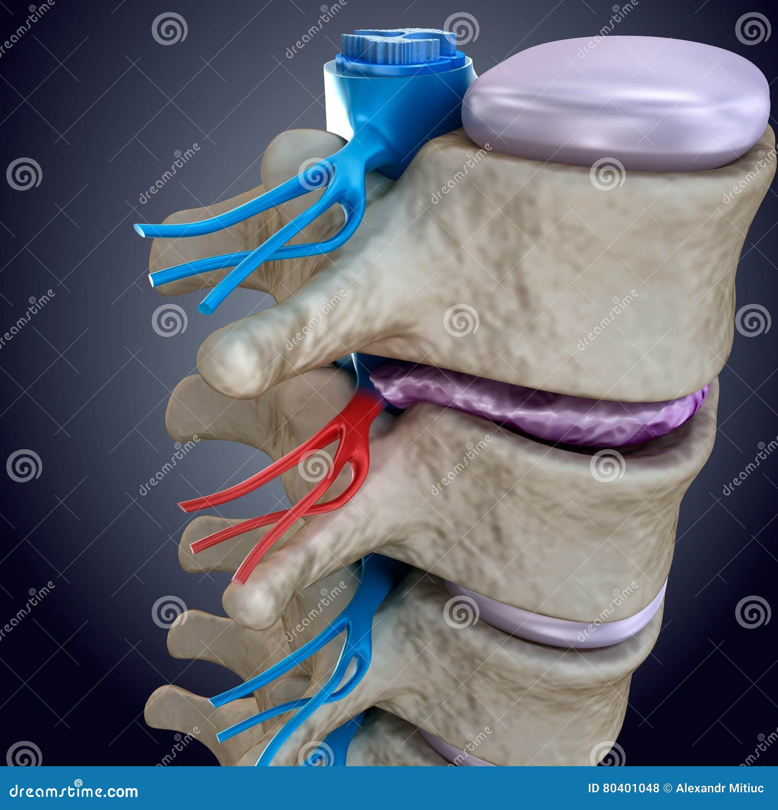 spinal cord under pressure of bulging disc