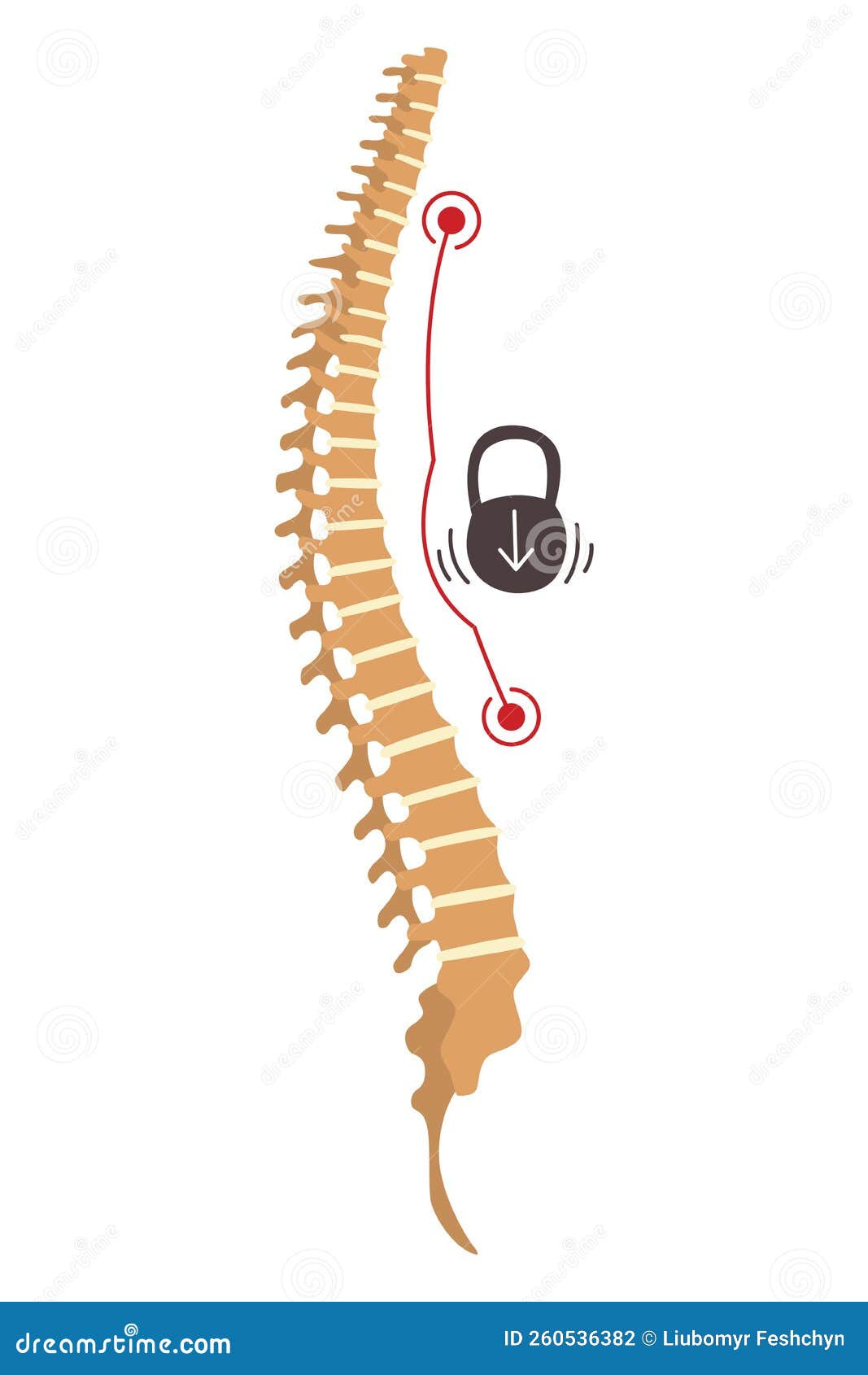 spinal deformity.  of spine curvatures or unhealthy backbones. human spine anatomy, curved spine. diagram with