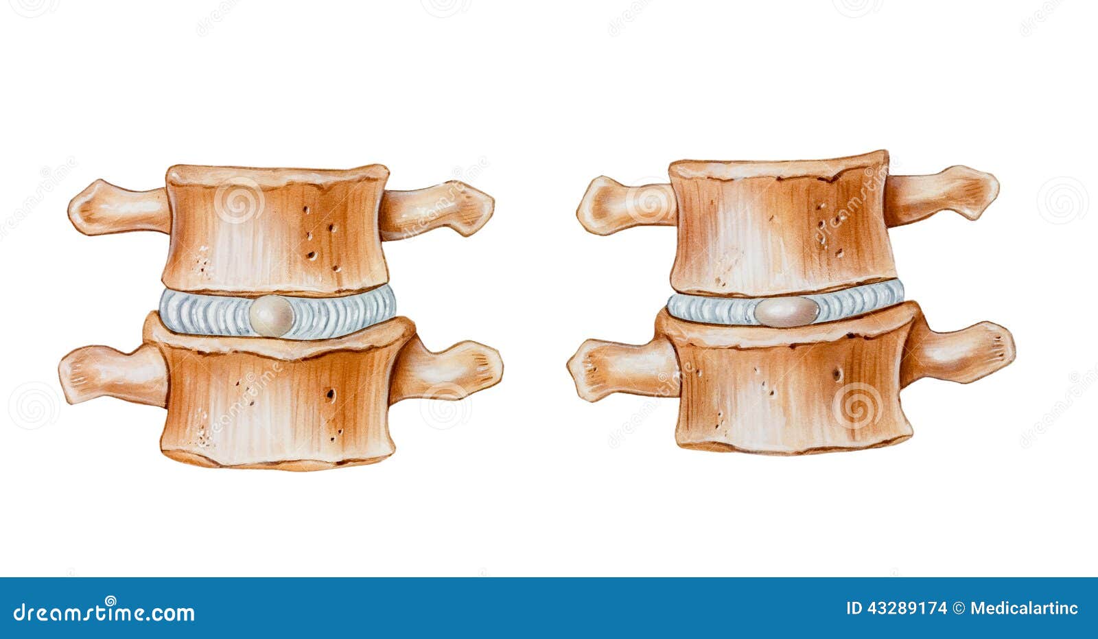 Spine Cushioning Function Of Intervertebral Discs Stock Photo Image