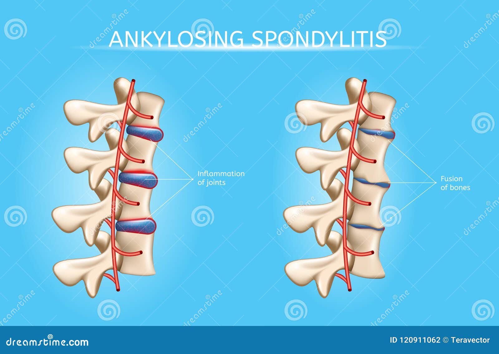 Spine Symptoms Chart