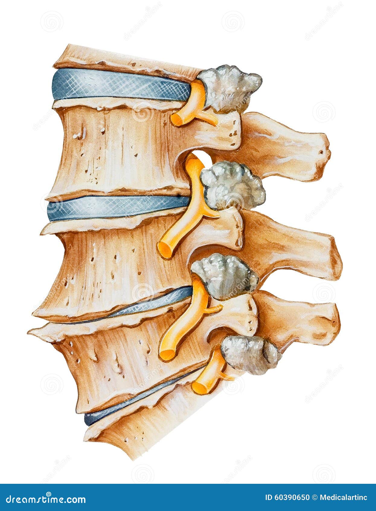 spine - lumbar osteoarthritic and spondylitic arthritis