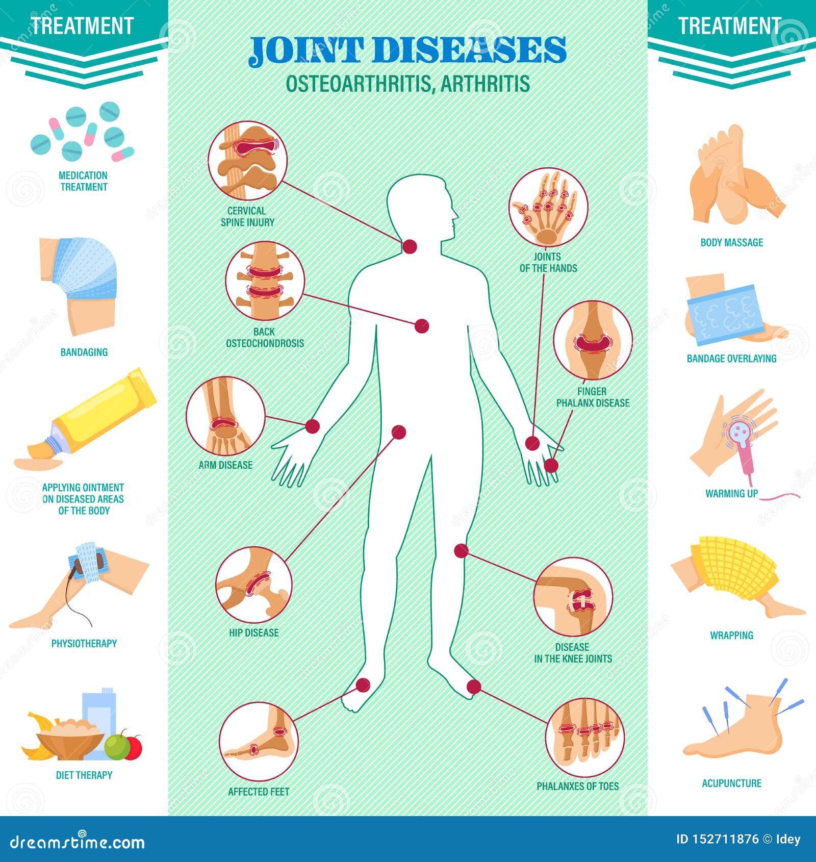 osteoarthritis symptoms