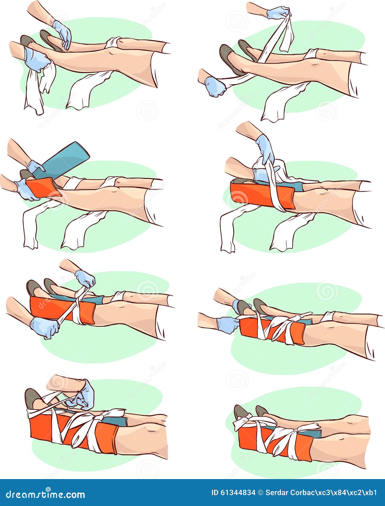 First Aid Pictures For Fractures