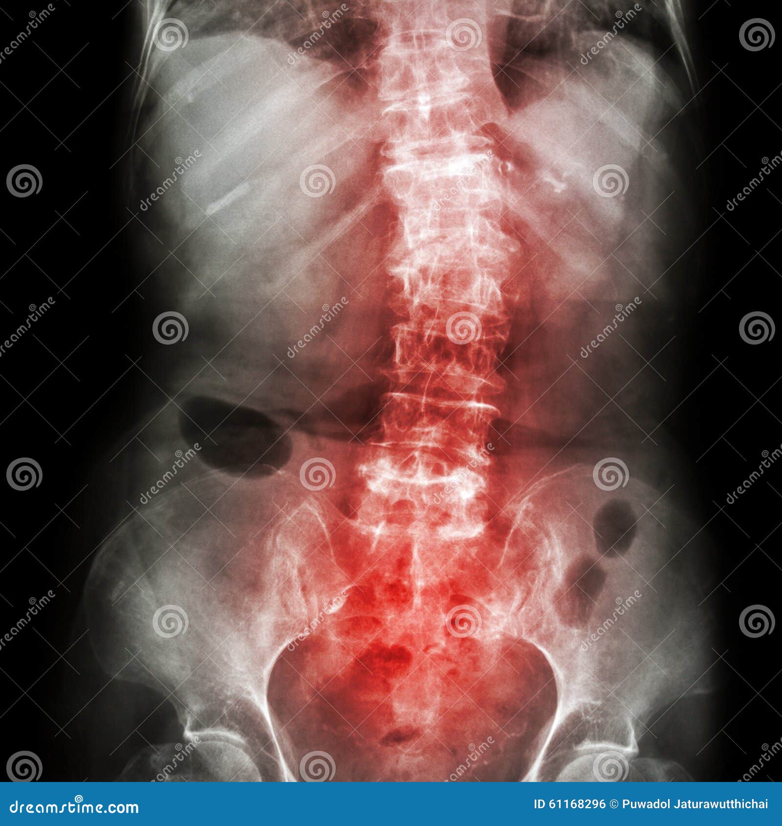 sacrum anatomy xray