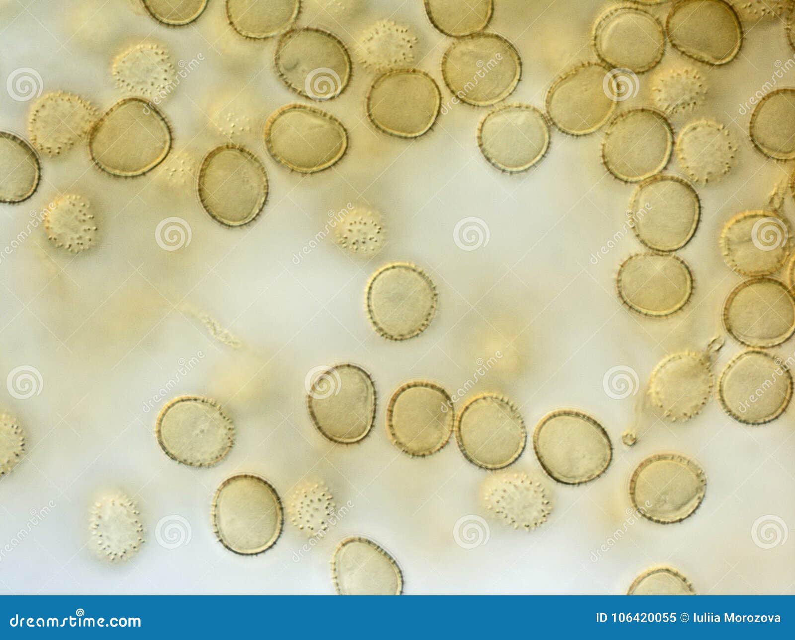 spores of a slime mold. microscopy