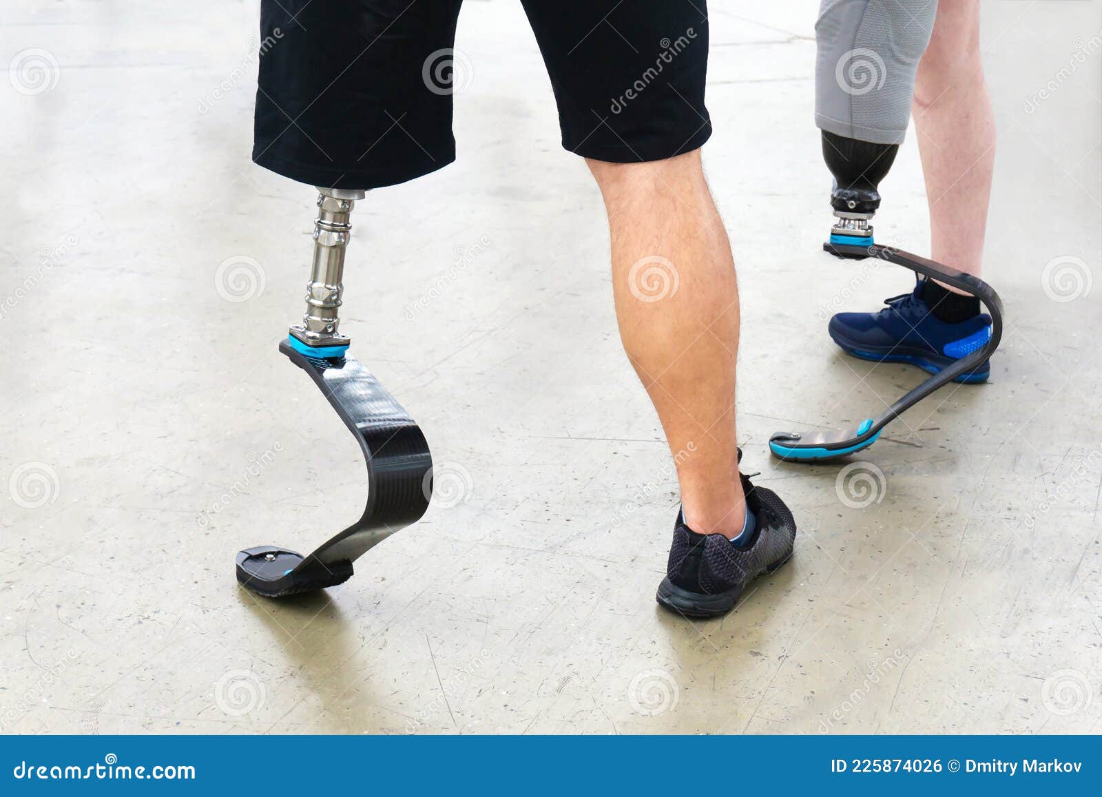 Cropped image of young disabled woman with prosthetic leg Stock