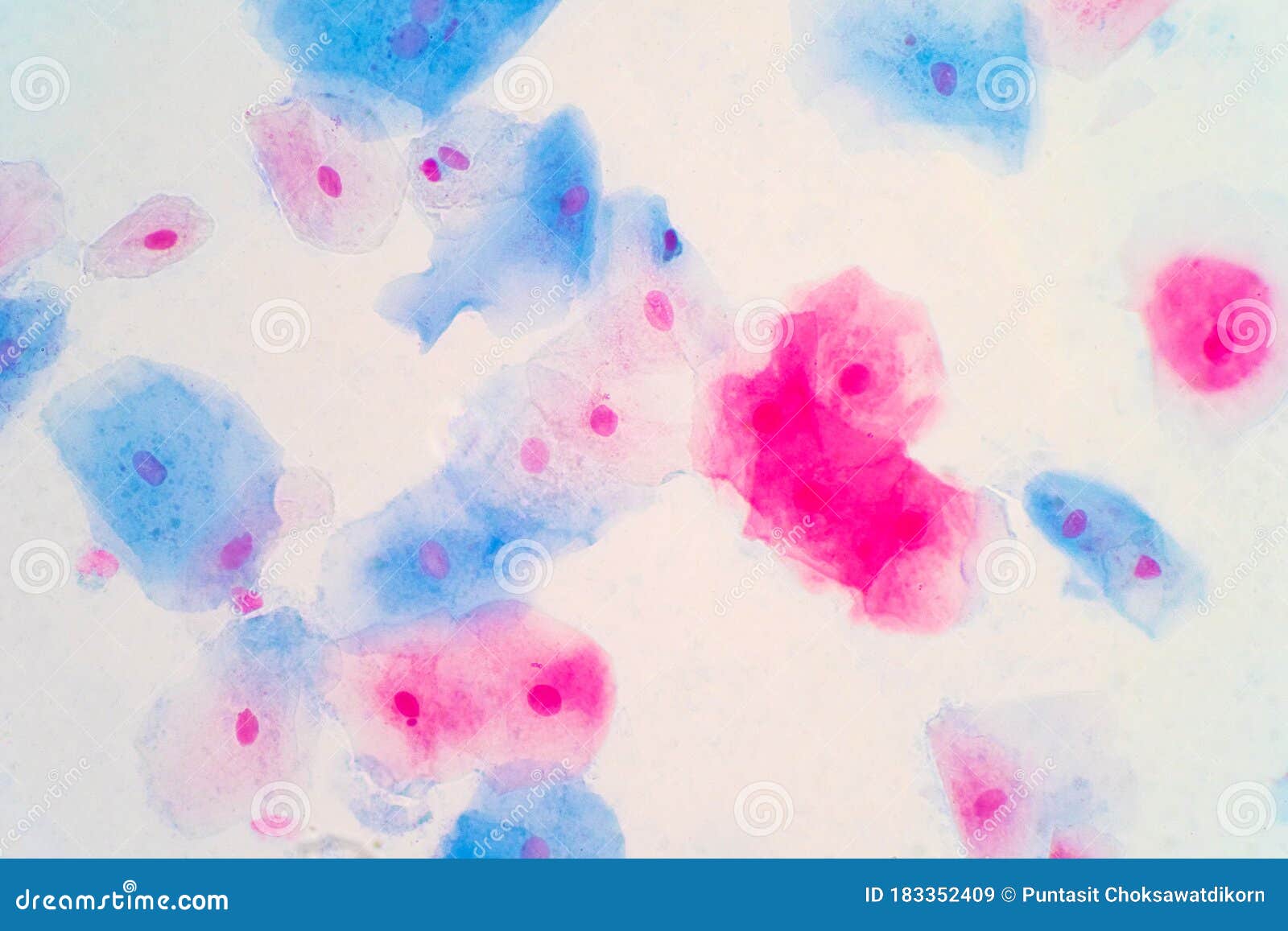 squamous epithelial cells of human cervix under the microscope view