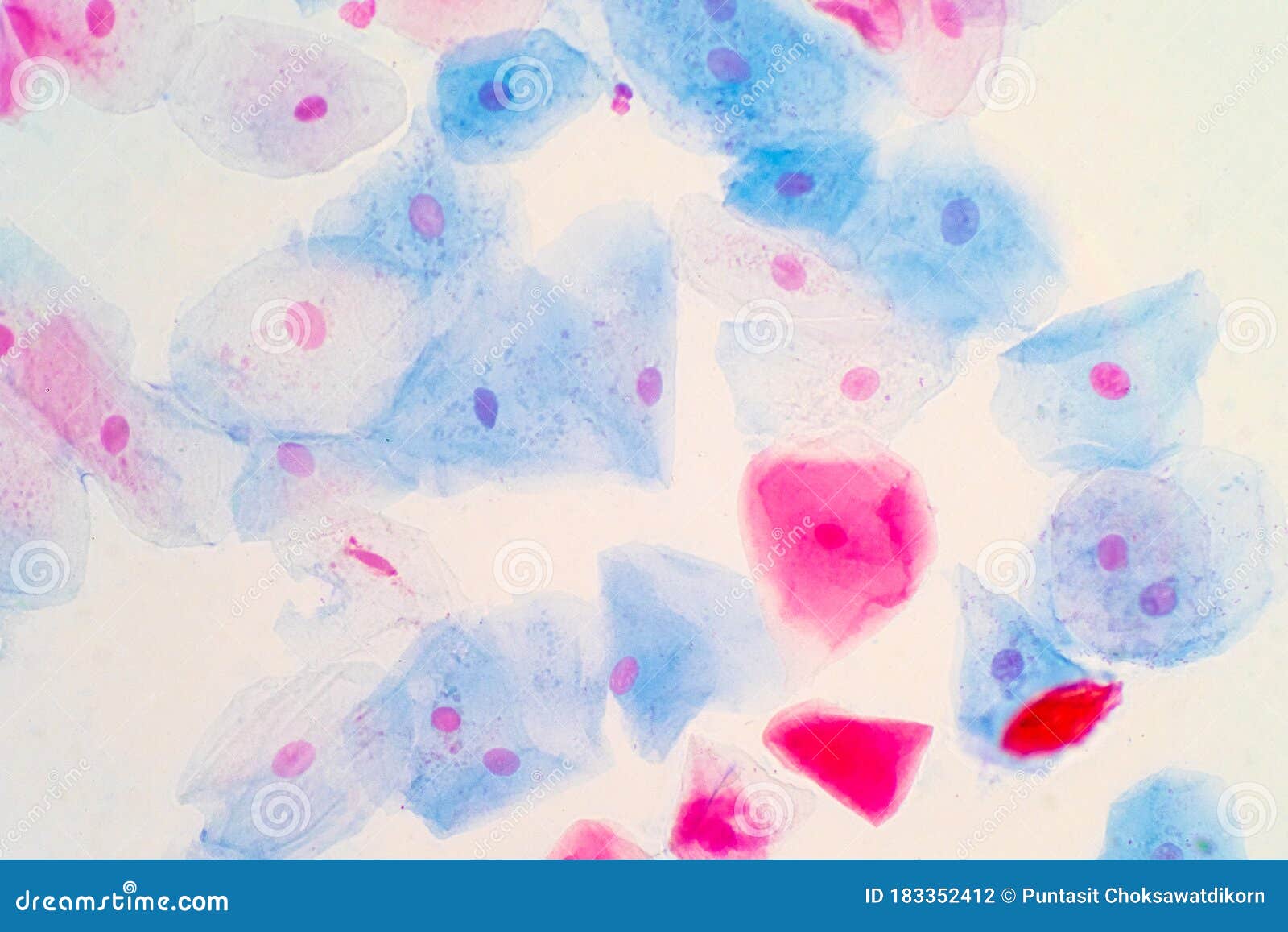 squamous epithelial cells of human cervix under the microscope view