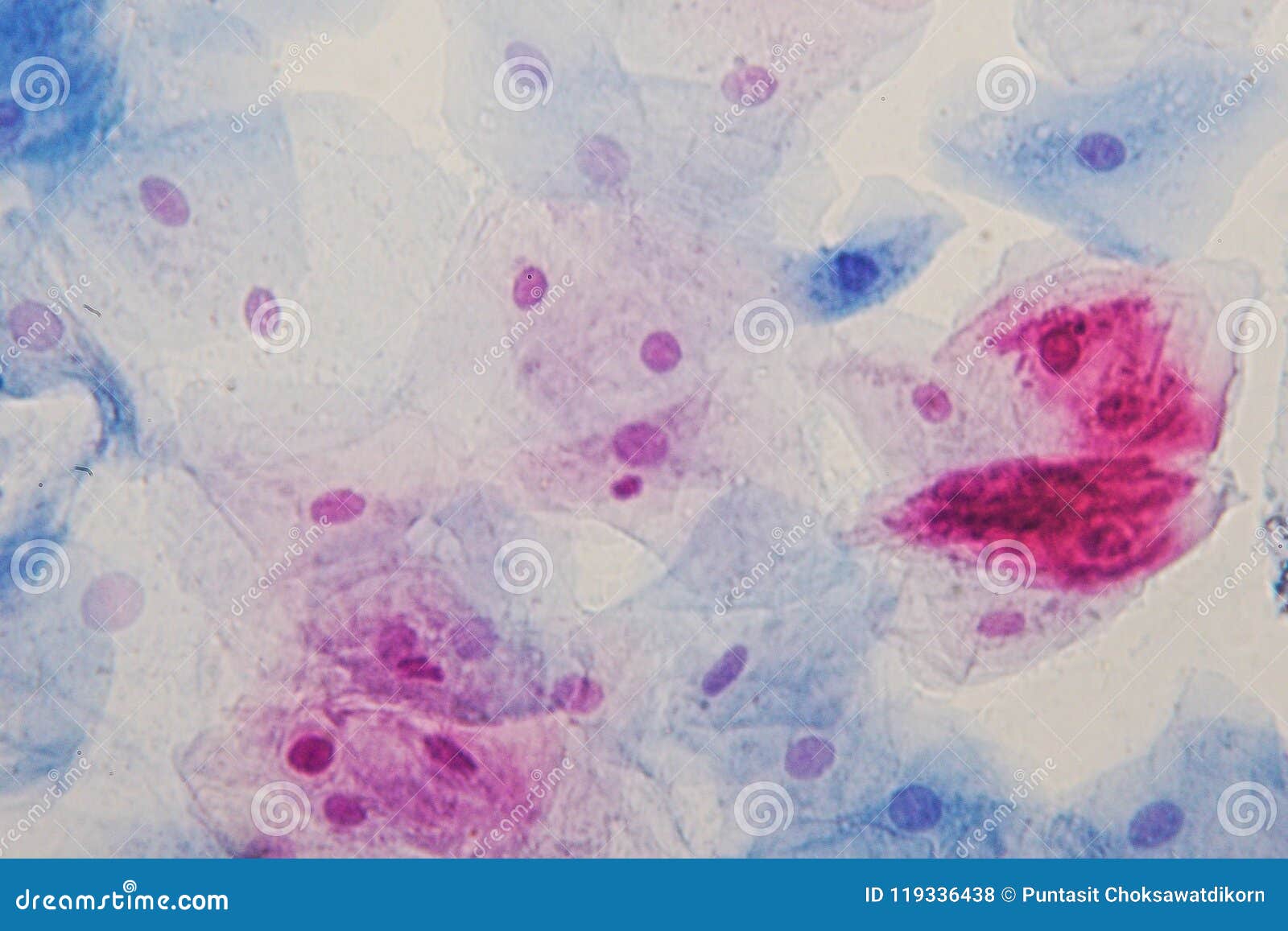 squamous epithelial cells under microscope view for education hi