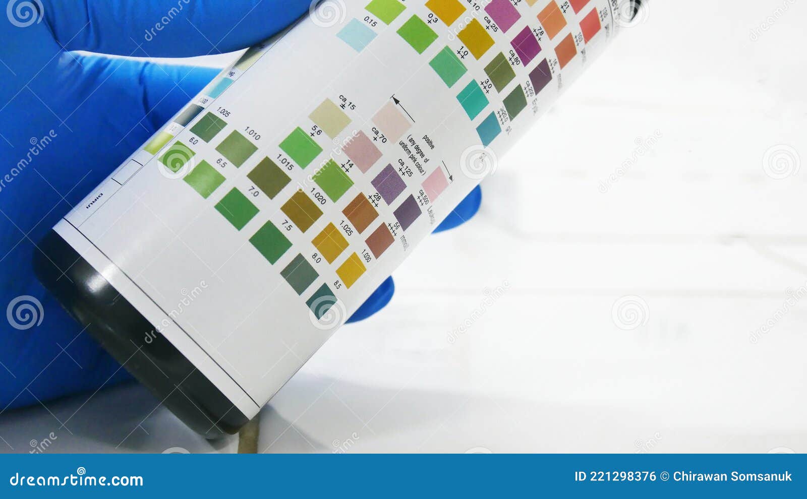 Srip Test Urinalysis in Laboratory Stock Photo Image of hand