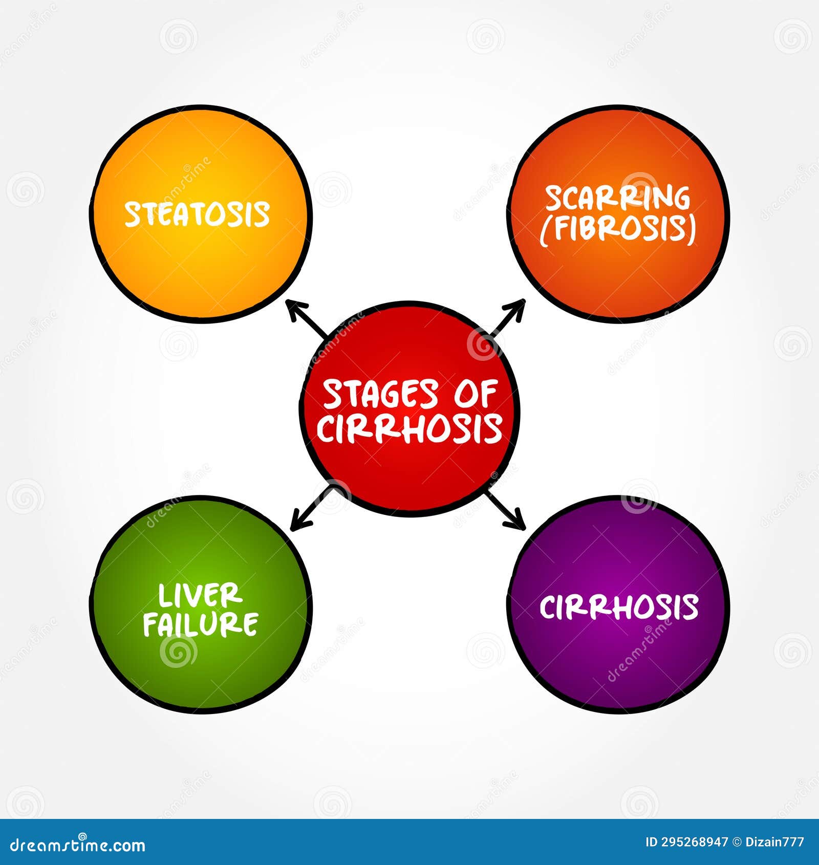 stages of cirrhosis - scarring of the liver caused by long-term liver damage