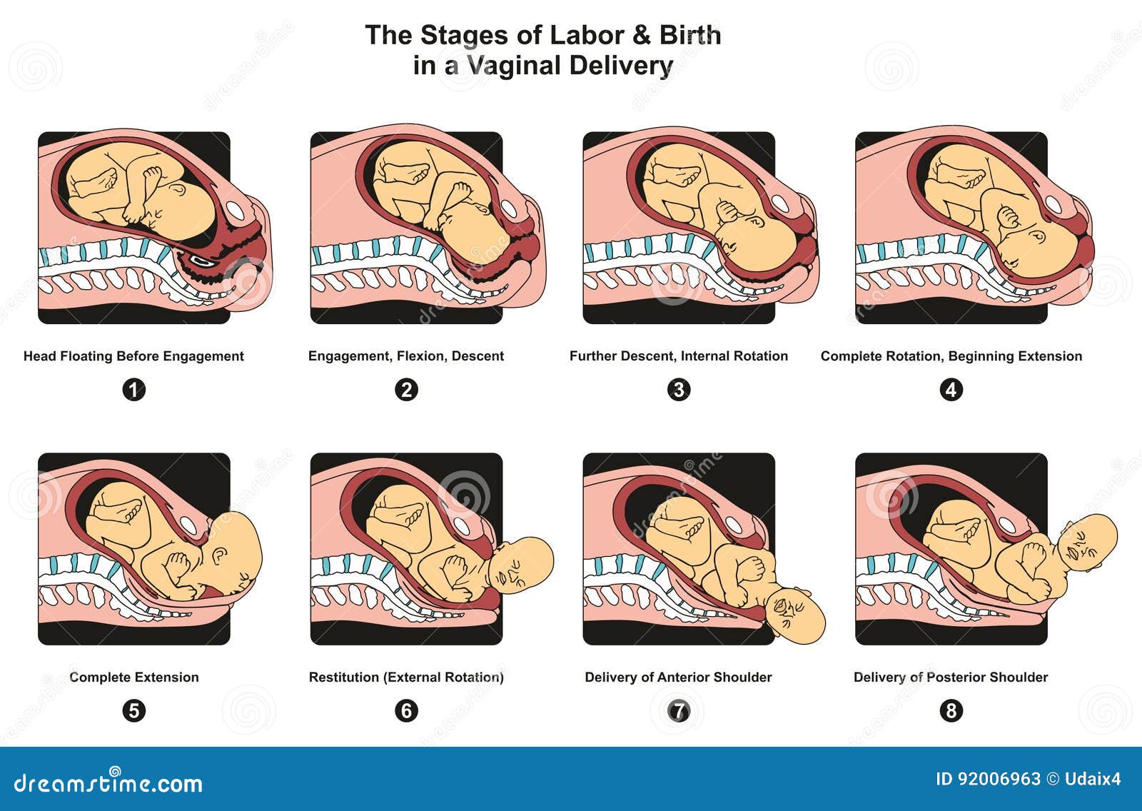 stages of labor and birth in a vaginal delivery