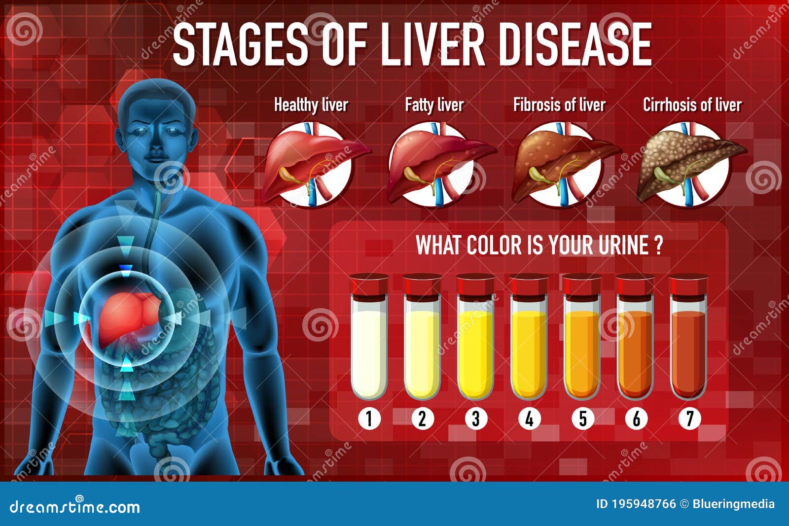 Stages Of Liver Damage. The First Symptoms Of Liver Problems Are