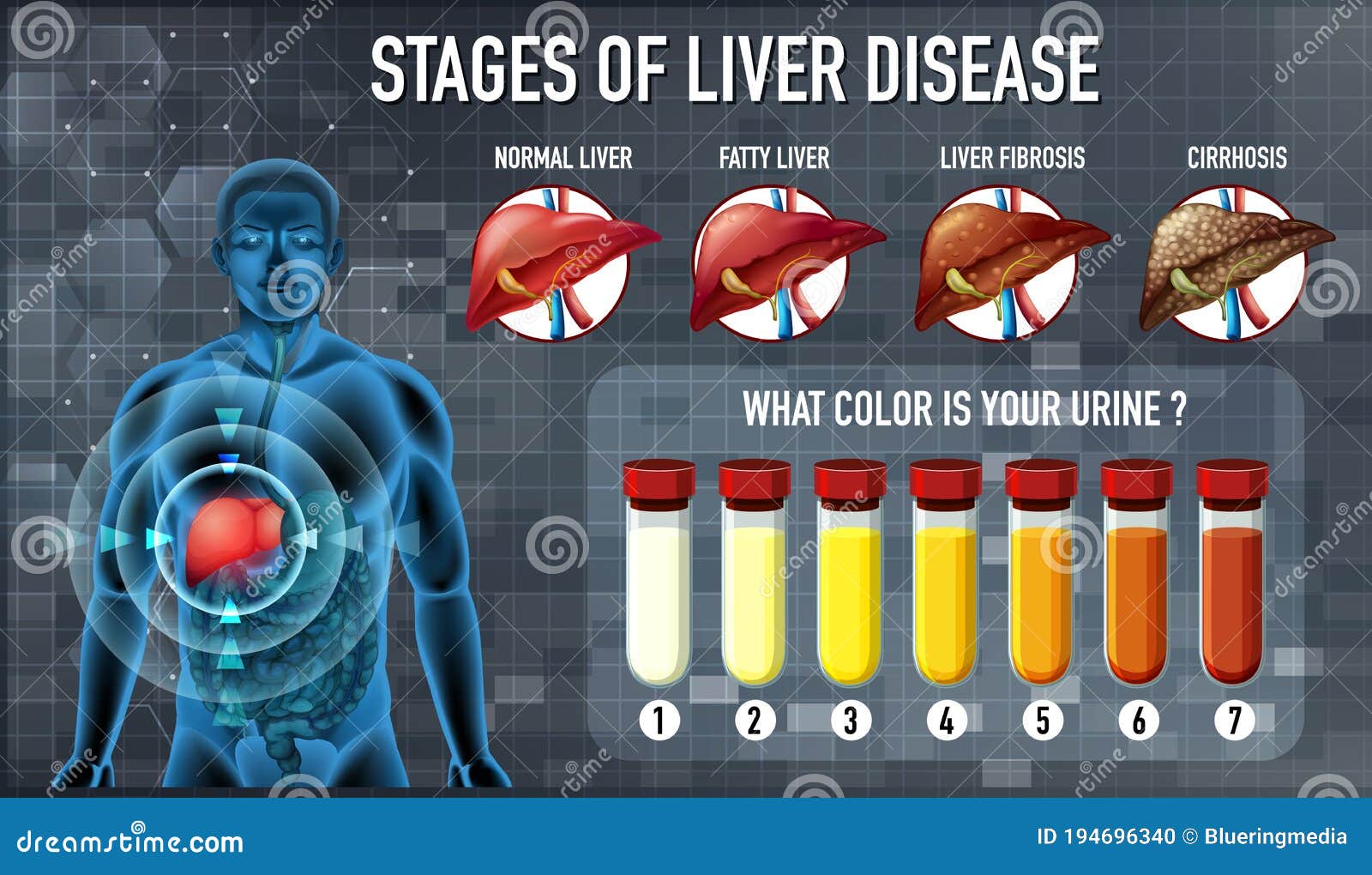 Stages Of Liver Damage. The First Symptoms Of Liver Problems Are