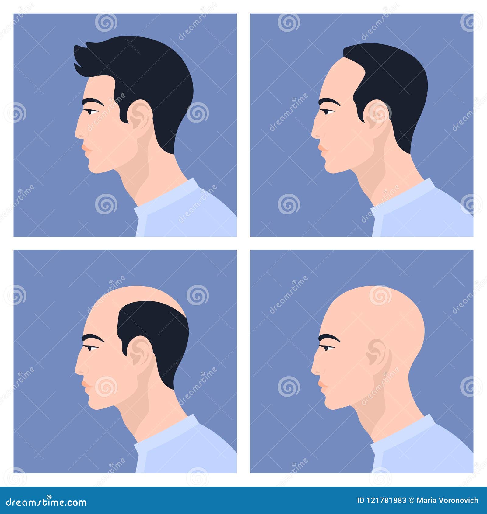 17 Best Hair Loss Treatments for Men in 2023