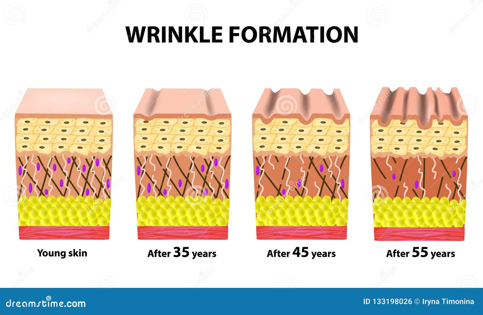 stages of wrinkles at different ages. anatomical structure of the skin. elastin, hyaluronic acid, collagen. infographics