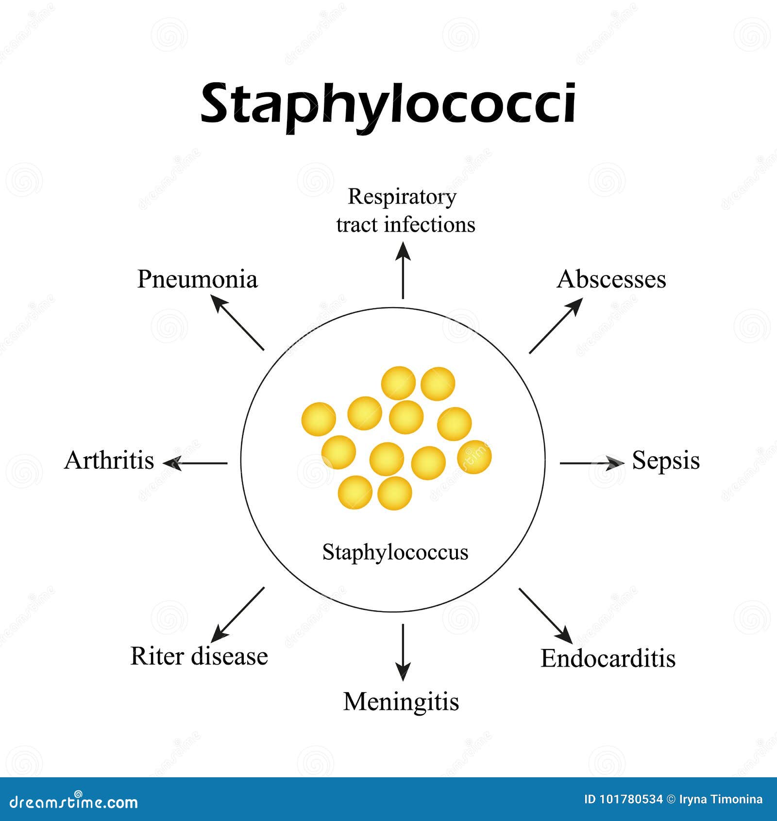 Staphylococci. Staphylococcus Aureus Causes Diseases. Infographics
