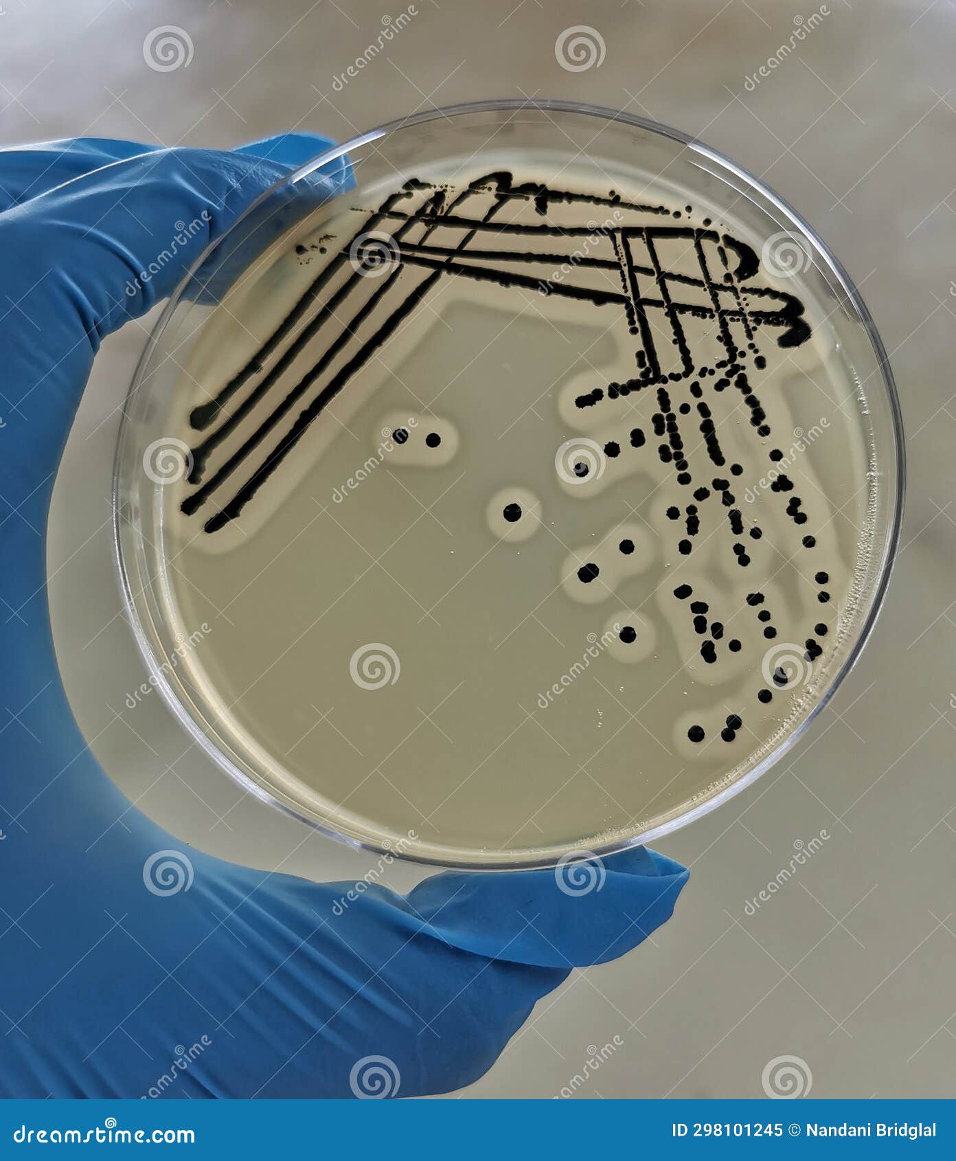 staphylococcus aureus on baird-parker agar