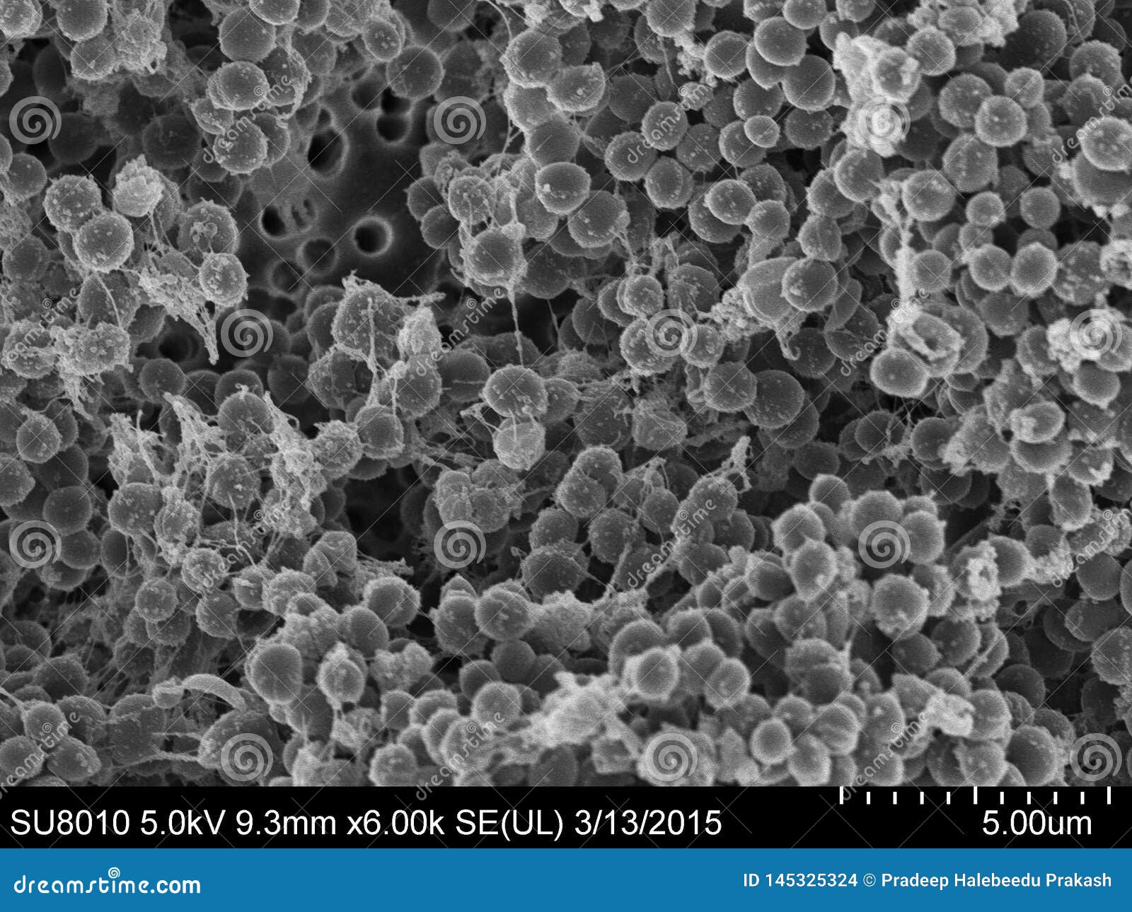 staphylococcus aureus scanning electron microscopy 