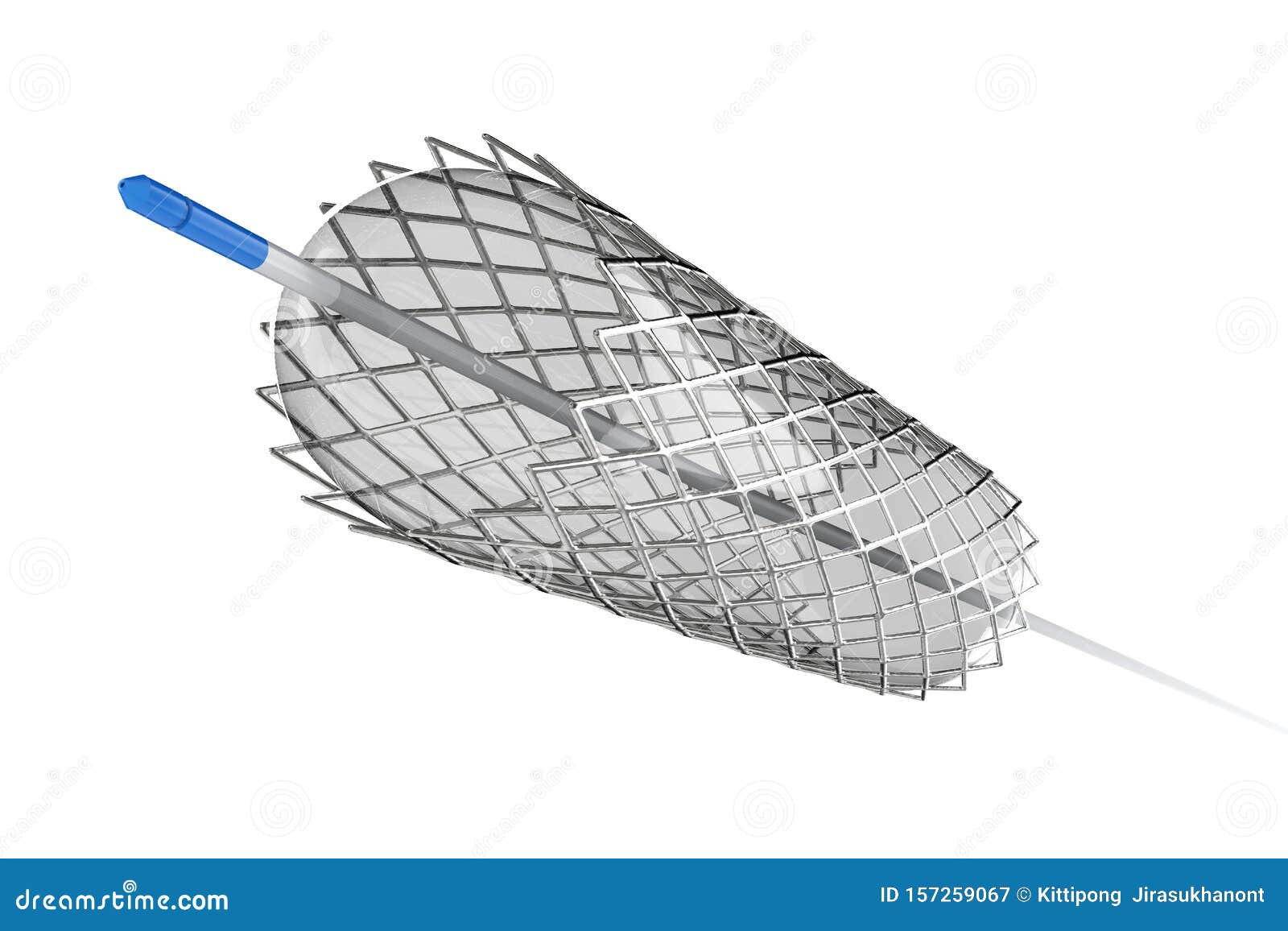 Stent for Balloon Angioplasty Stock Illustration Illustration of