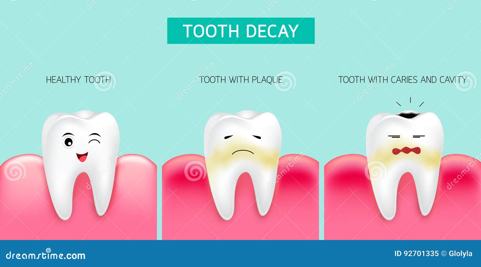 an examination of caries and decaying teeth Dental caries (tooth decay) dental caries or cavities, more commonly known as tooth decay, are caused by a breakdown of the tooth enamel this breakdown is the result. an examination of caries and decaying teeth Dental caries (tooth decay) dental caries or cavities, more commonly known as tooth decay, are caused by a breakdown of the tooth enamel this breakdown is the result.