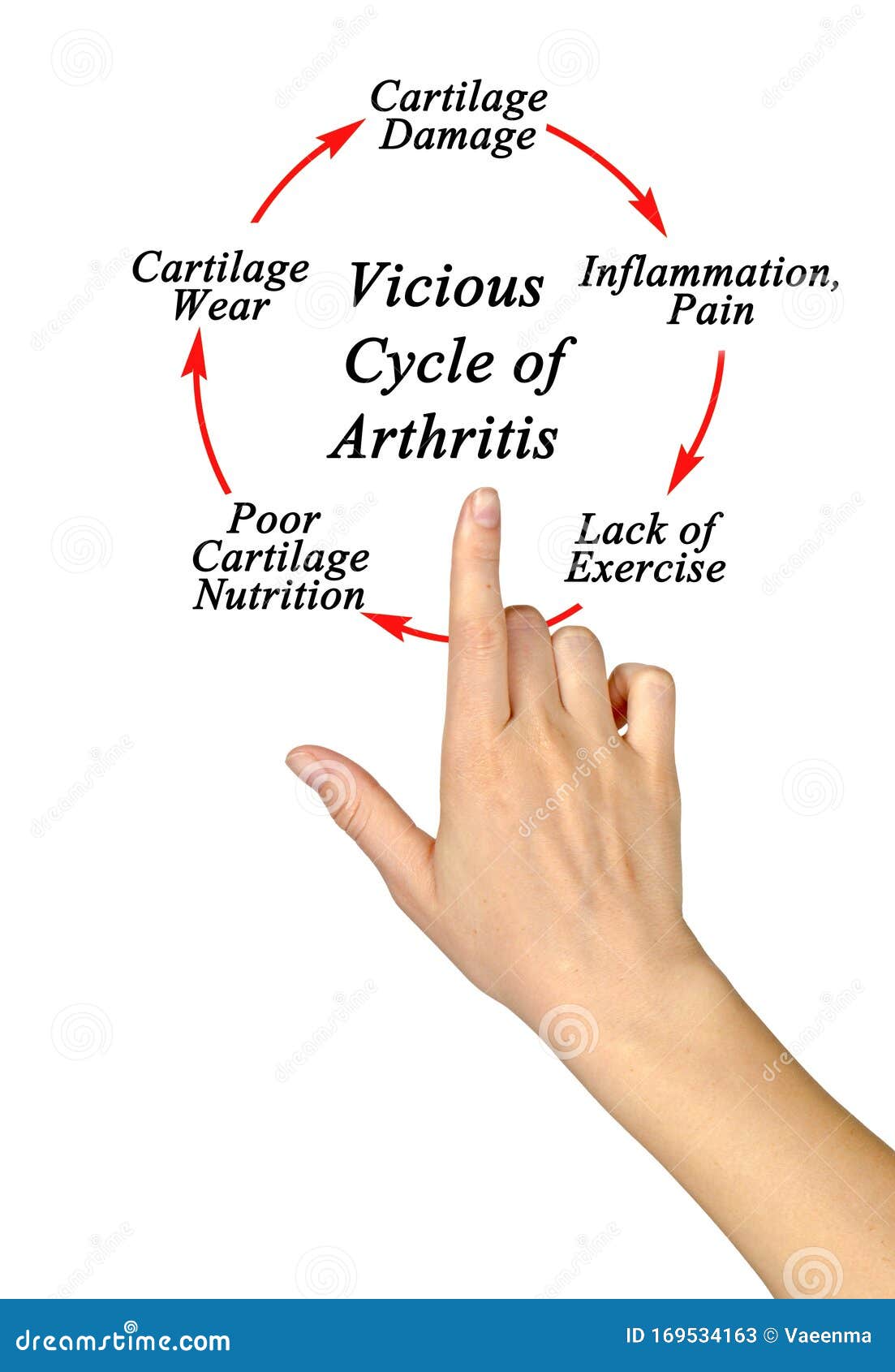 Vicious Cycle of Arthritis stock image. Image of hand 169534163