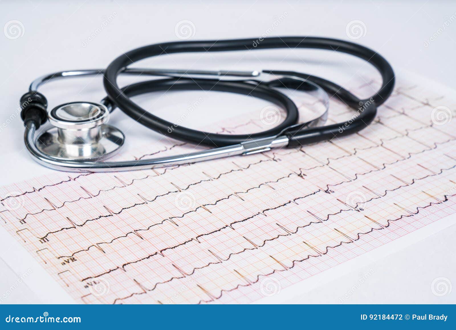 Stethoscope on EKG Graph Report Stock Photo Image of cardio, pulse
