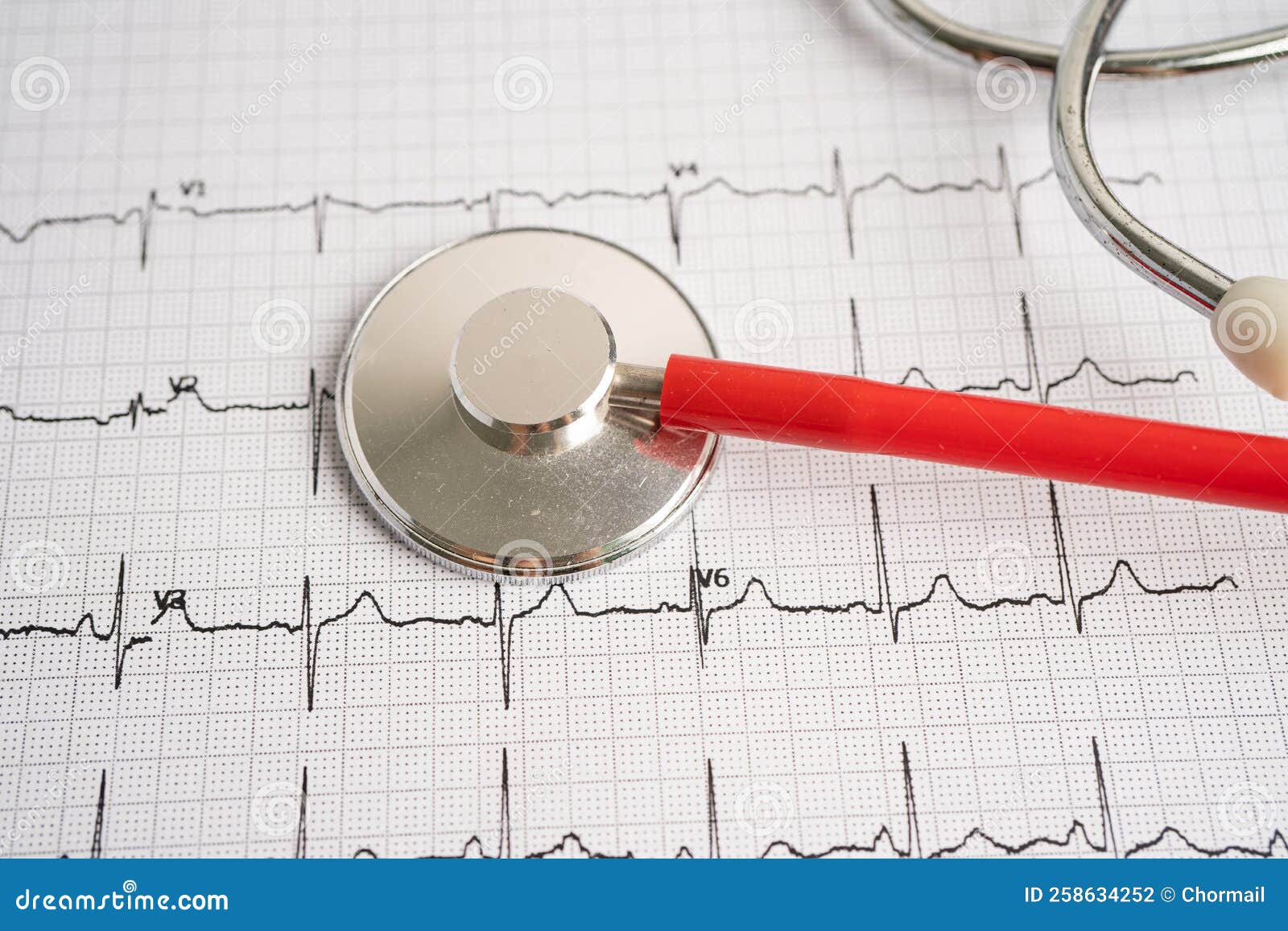 Stethoscope on Electrocardiogram ECG, Heart Wave, Heart Attack